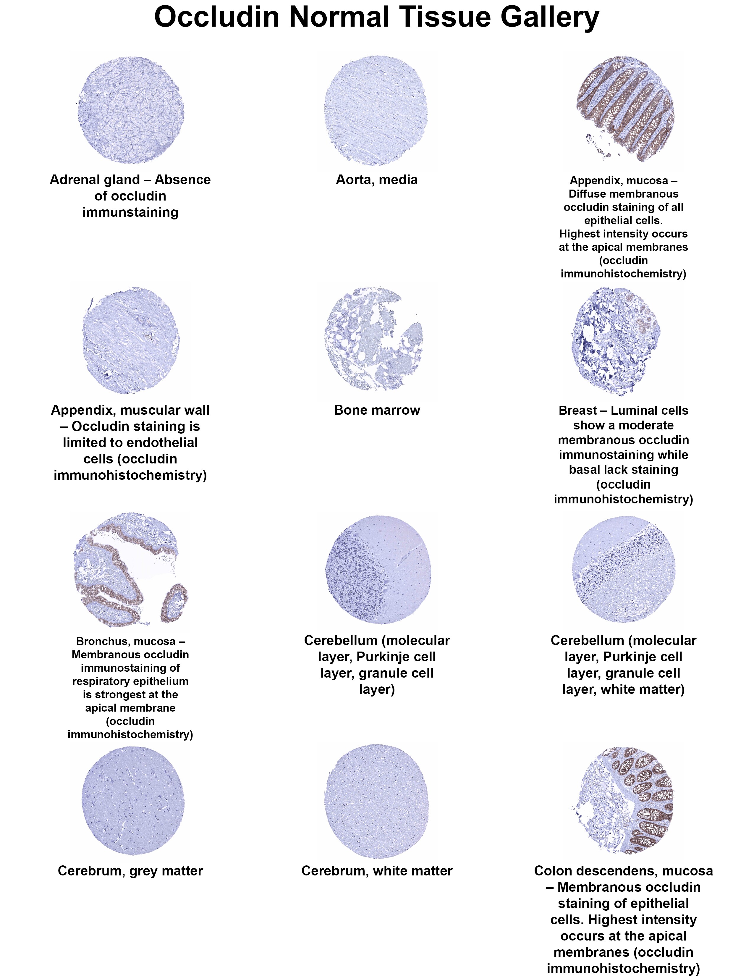 Occludin Antibody (MSVA-415M) Occludin Antibody (MSVA-415M) Occludin Normal Tissue Gallery