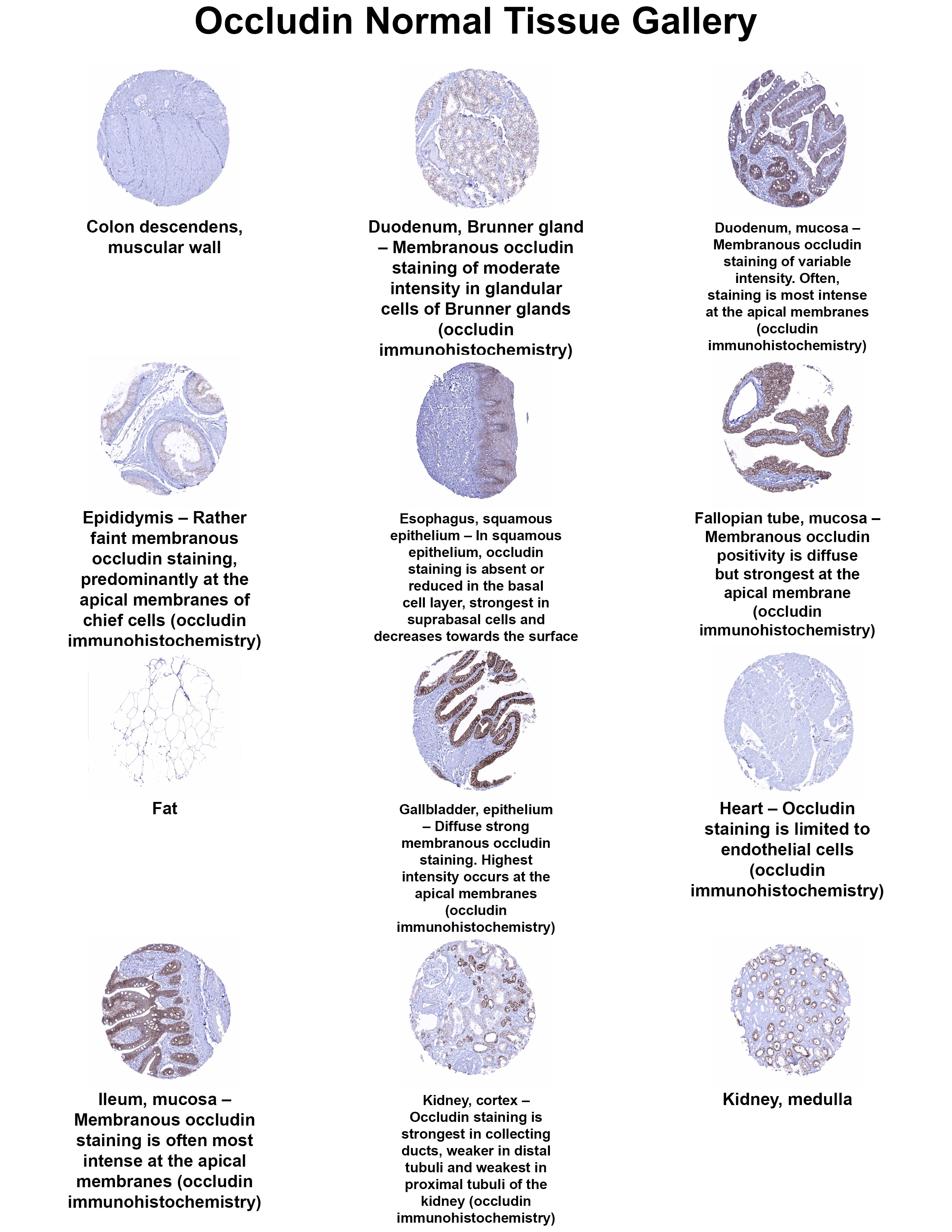 Occludin Antibody (MSVA-415M) Occludin Antibody (MSVA-415M) Occludin Normal Tissue Gallery