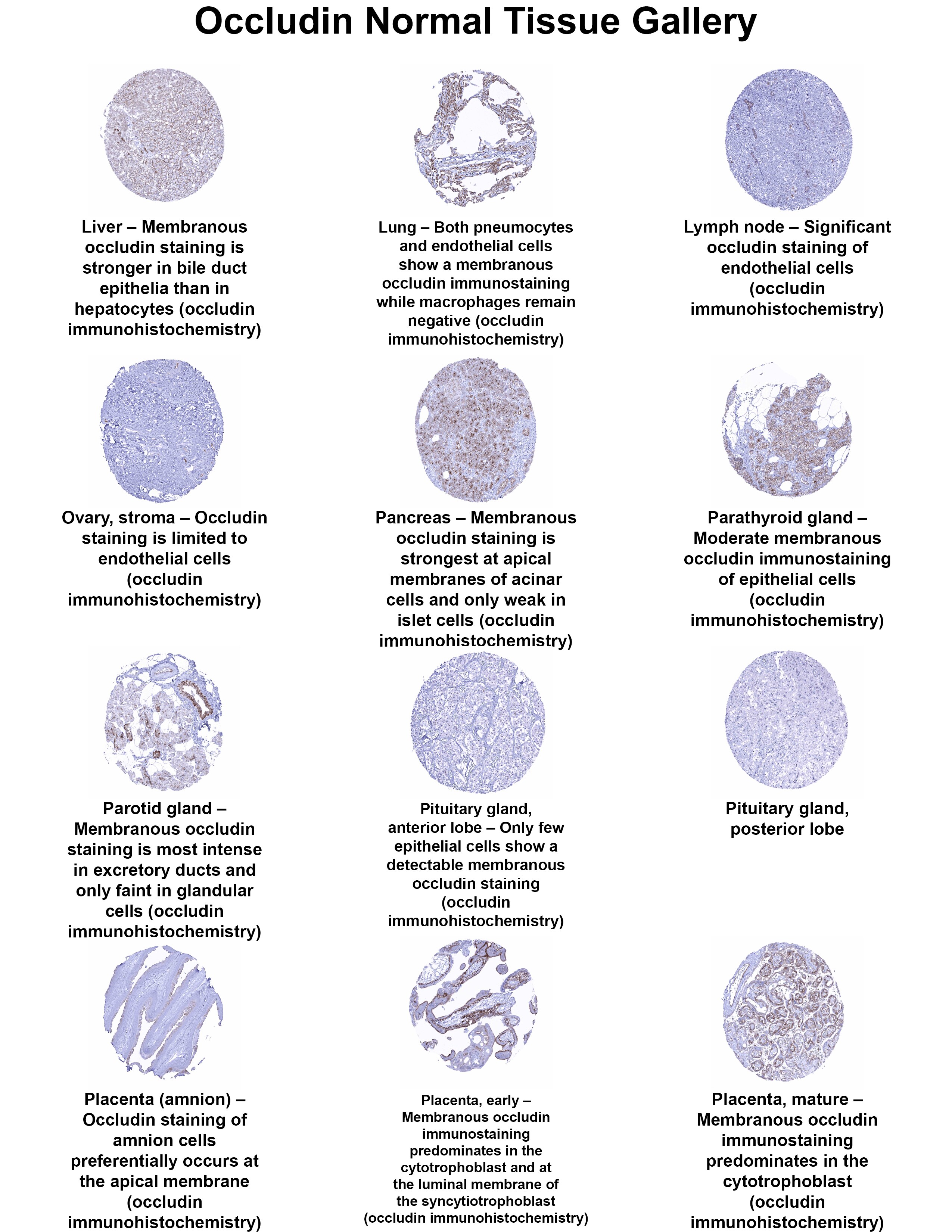 Occludin Antibody (MSVA-415M) Occludin Antibody (MSVA-415M) Occludin Normal Tissue Gallery