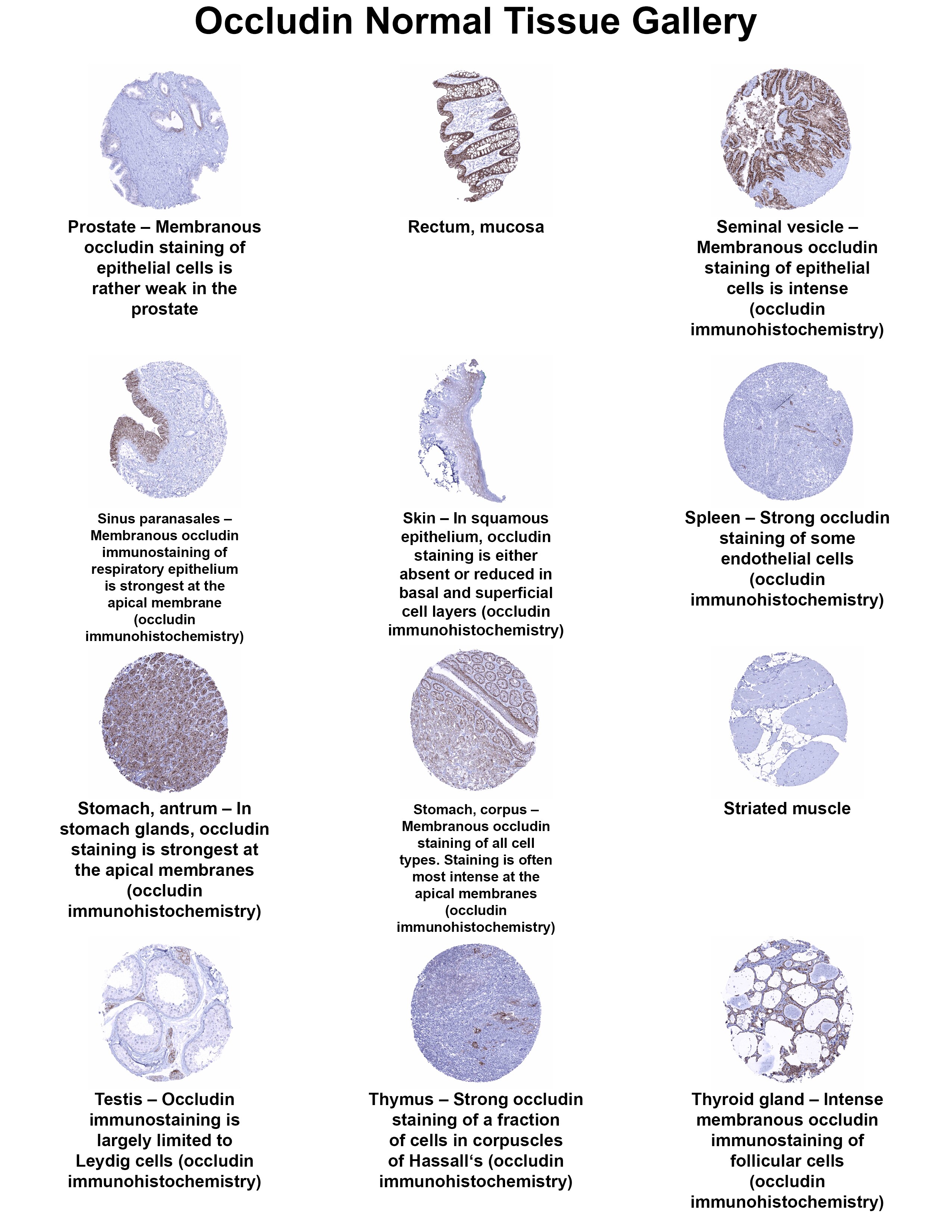 Occludin Antibody (MSVA-415M) Occludin Antibody (MSVA-415M) Occludin Normal Tissue Gallery