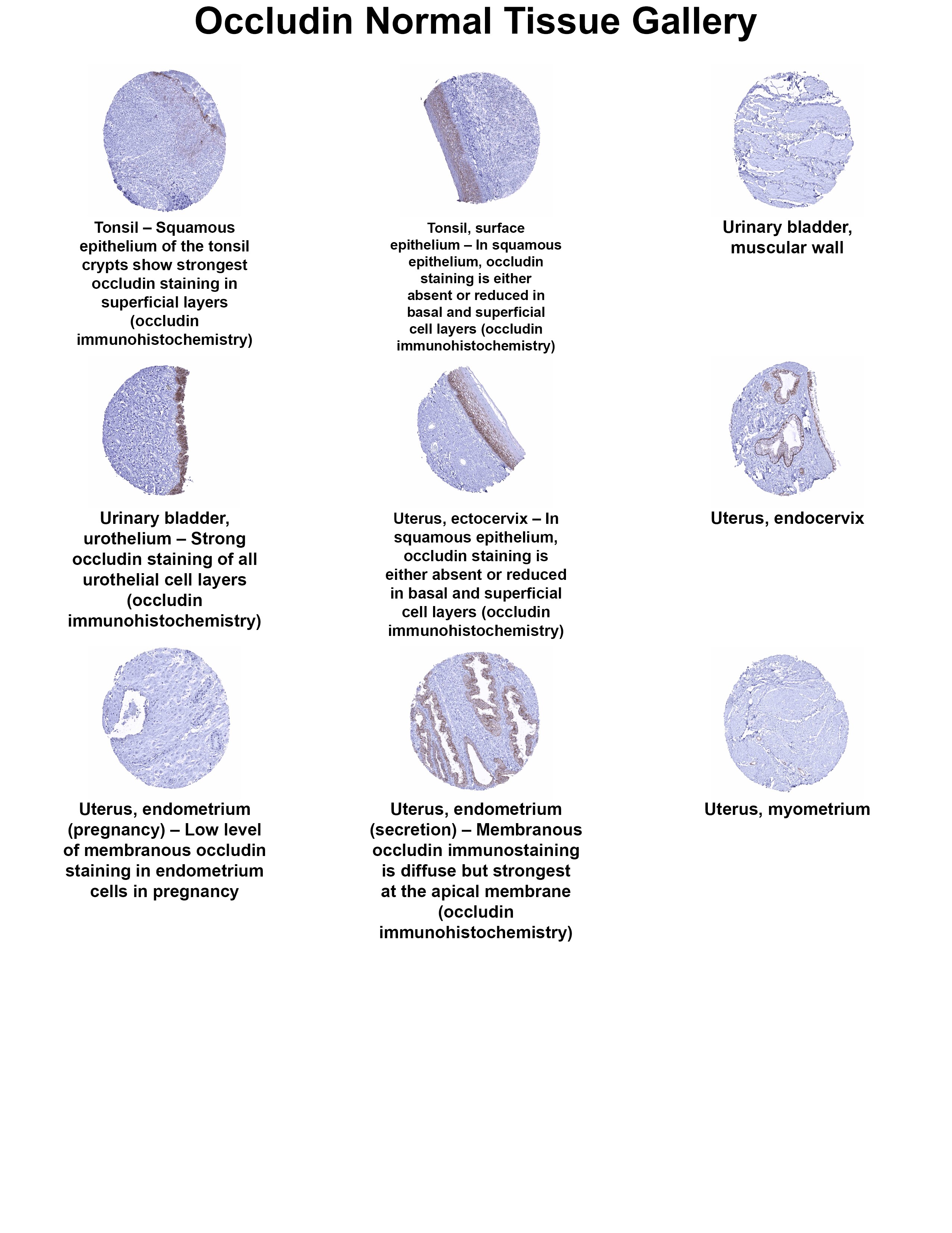 Occludin Antibody (MSVA-415M) Occludin Antibody (MSVA-415M) Occludin Normal Tissue Gallery