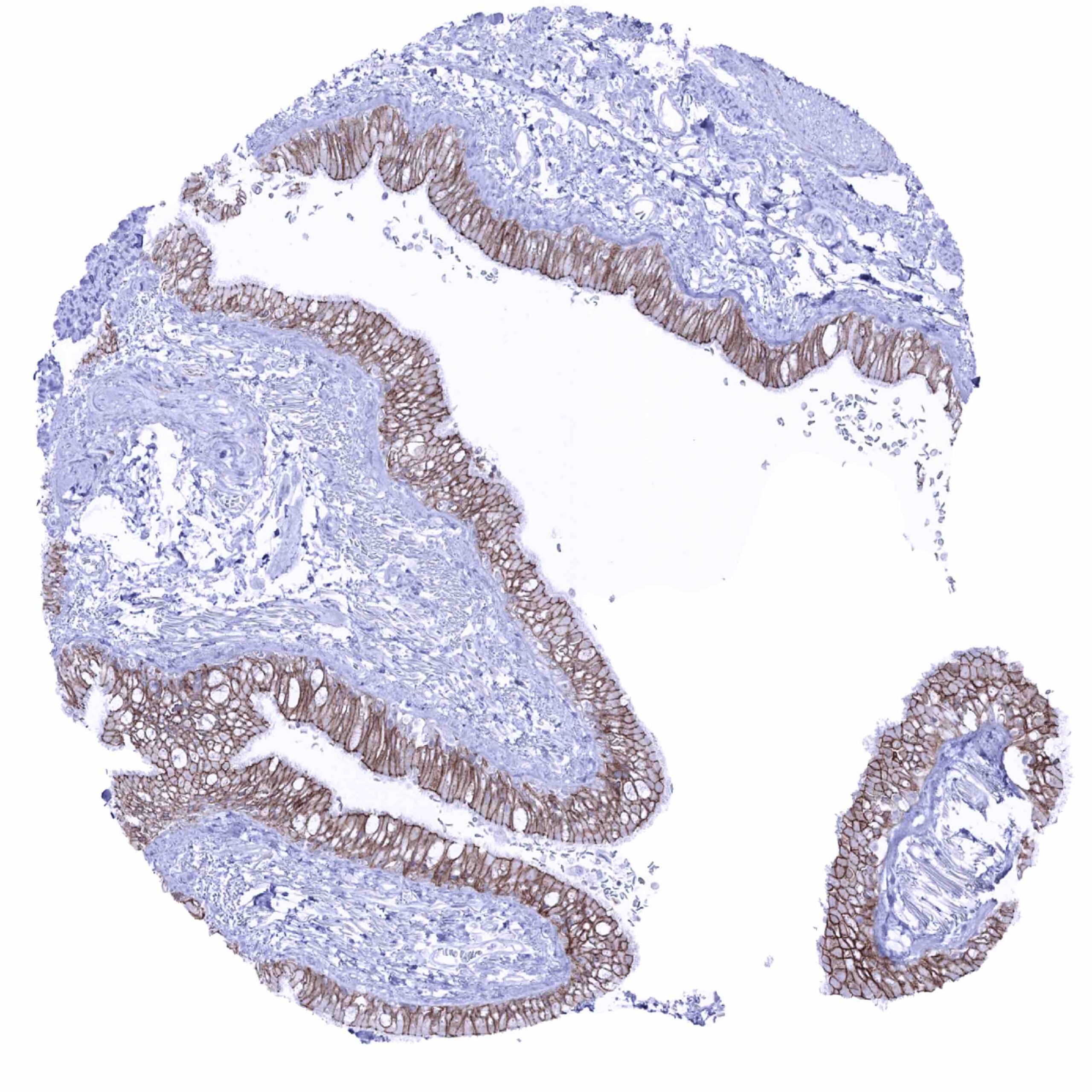 Occludin Antibody (MSVA-415M)