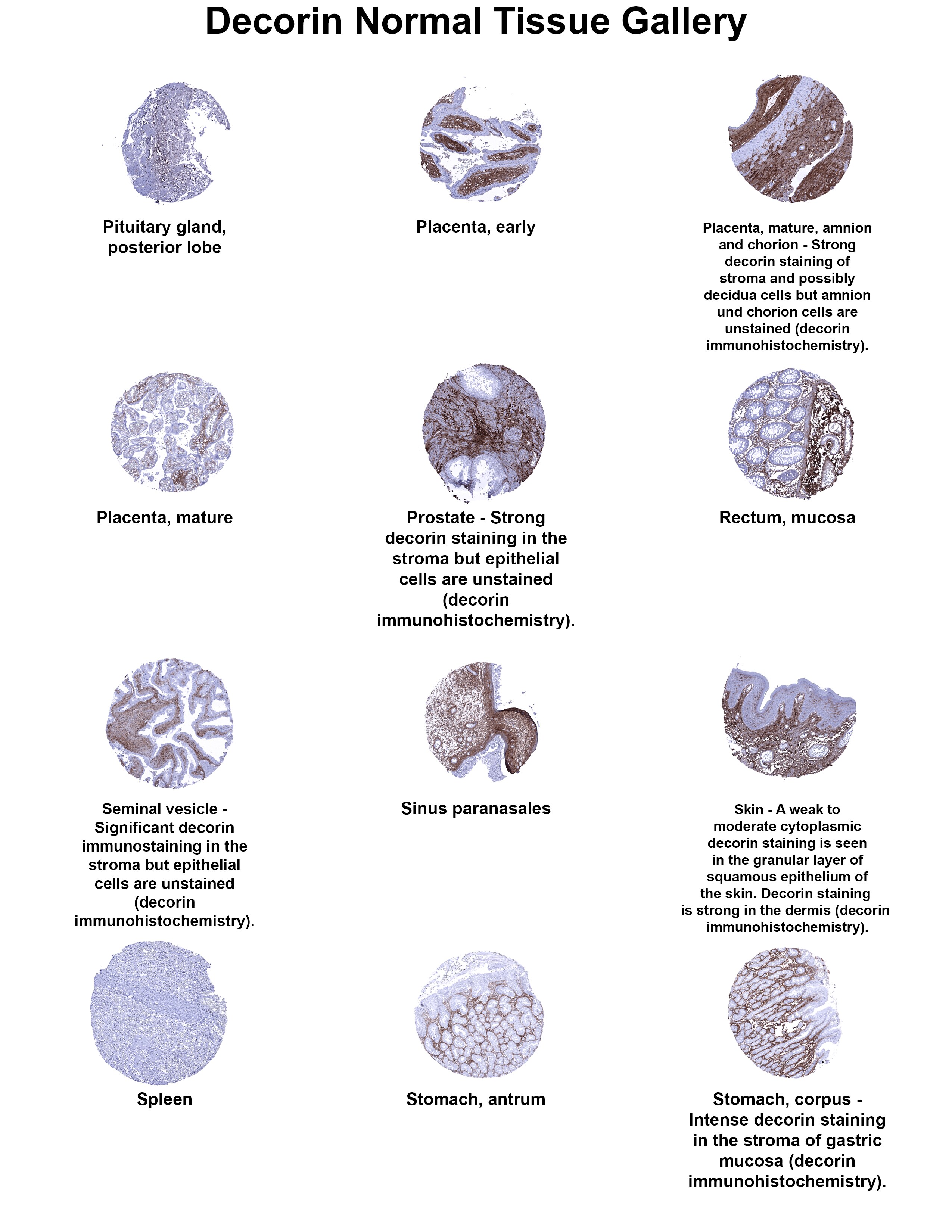 Decorin Antibody (MSVA-537R) Decorin Antibody (MSVA-537R) Decorin Normal Tissue Gallery
