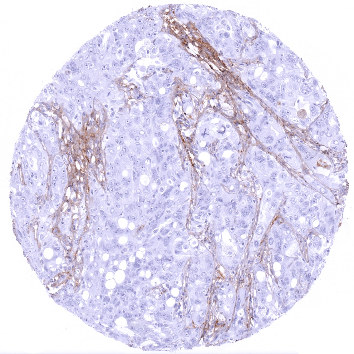 Decorin Antibody (MSVA-537R)