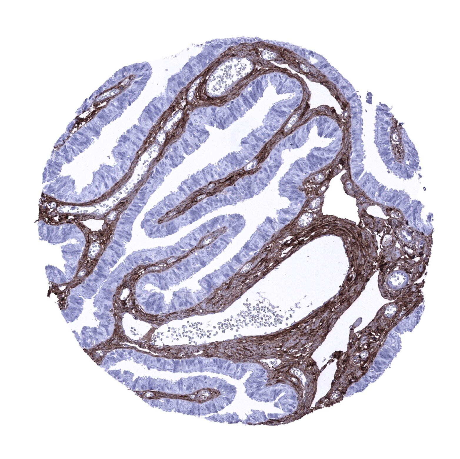 Decorin Antibody (MSVA-537R)