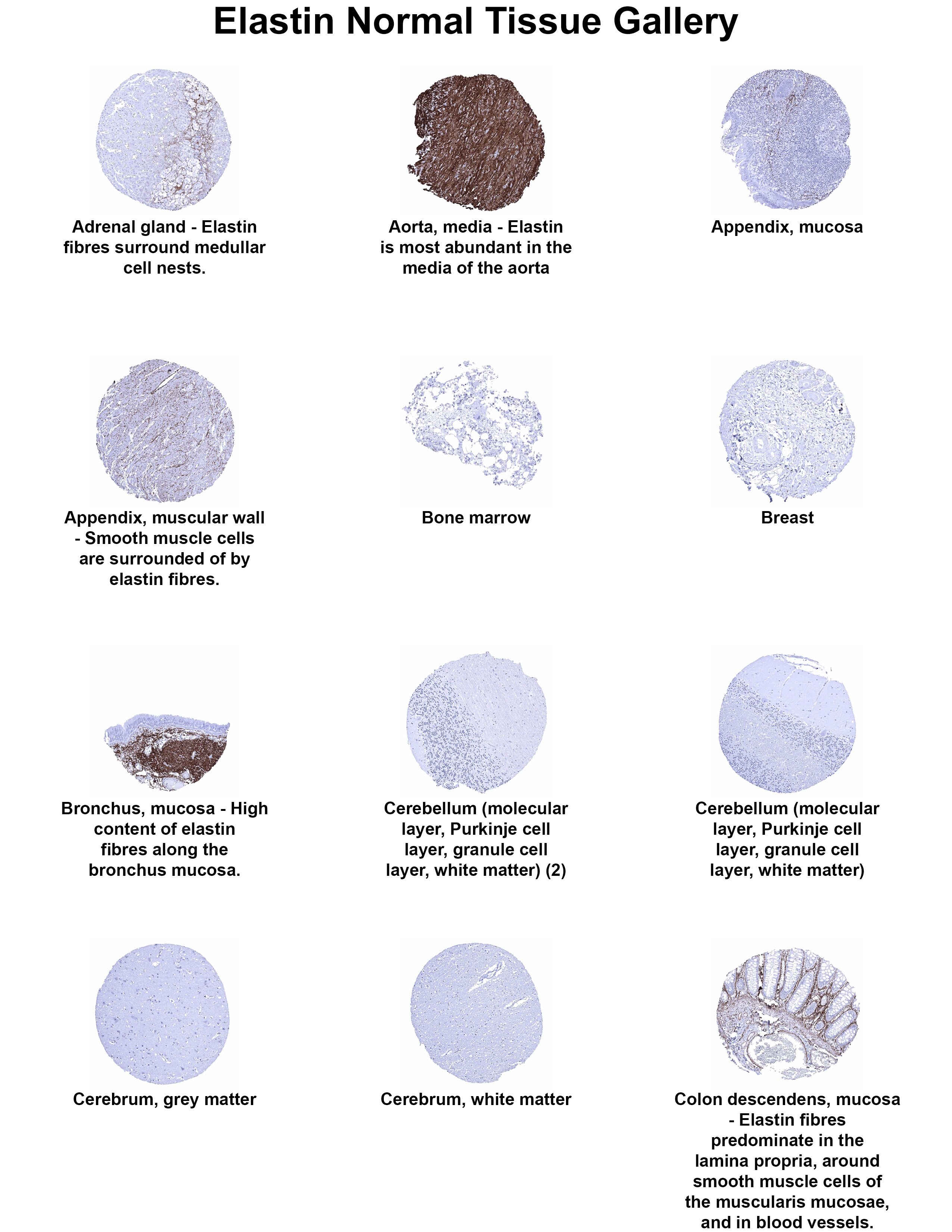 Elastin Antibody (MSVA-648R) Elastin Antibody (MSVA-648R) Elastin Normal Tissue Gallery