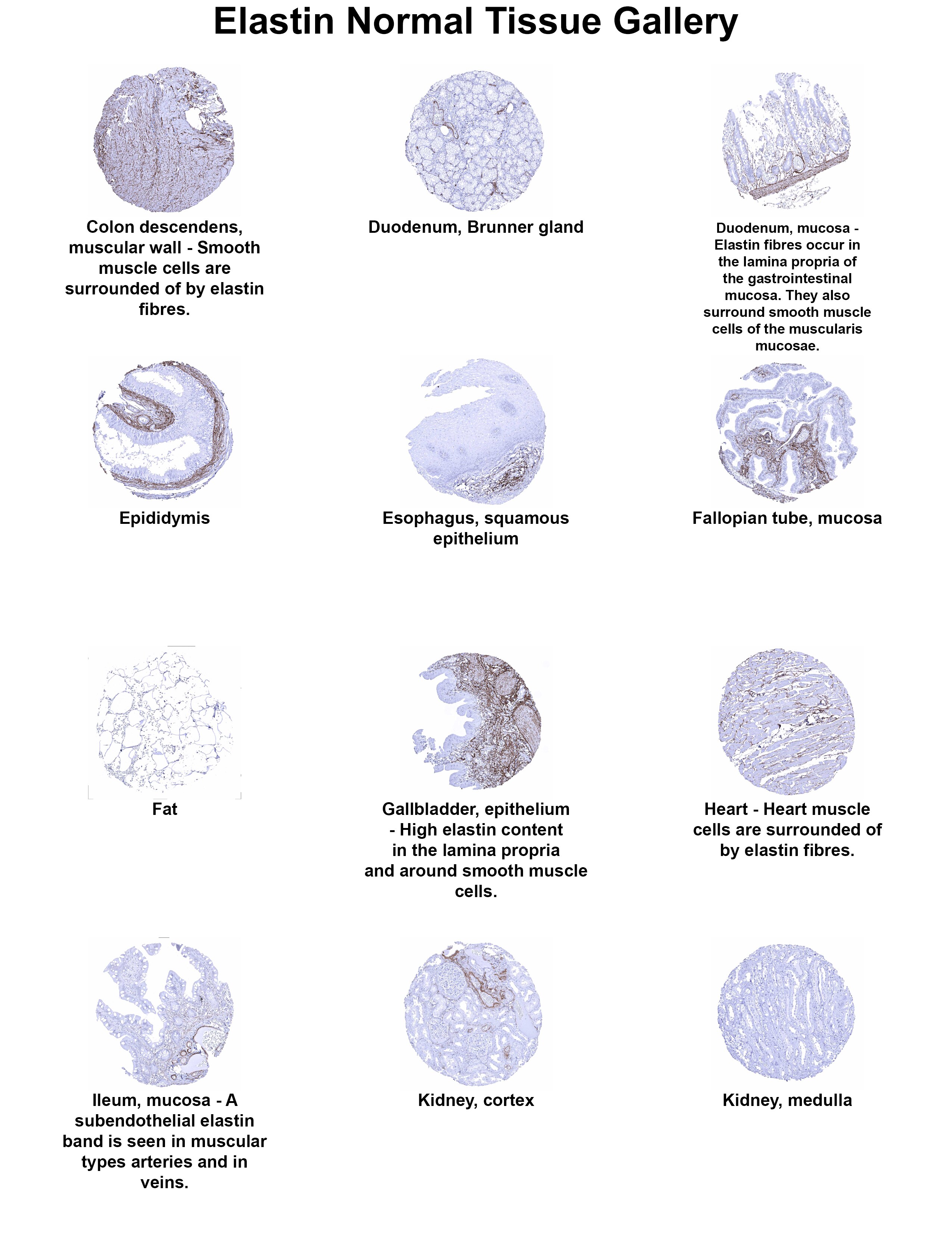 Elastin Antibody (MSVA-648R) Elastin Antibody (MSVA-648R) Elastin Normal Tissue Gallery