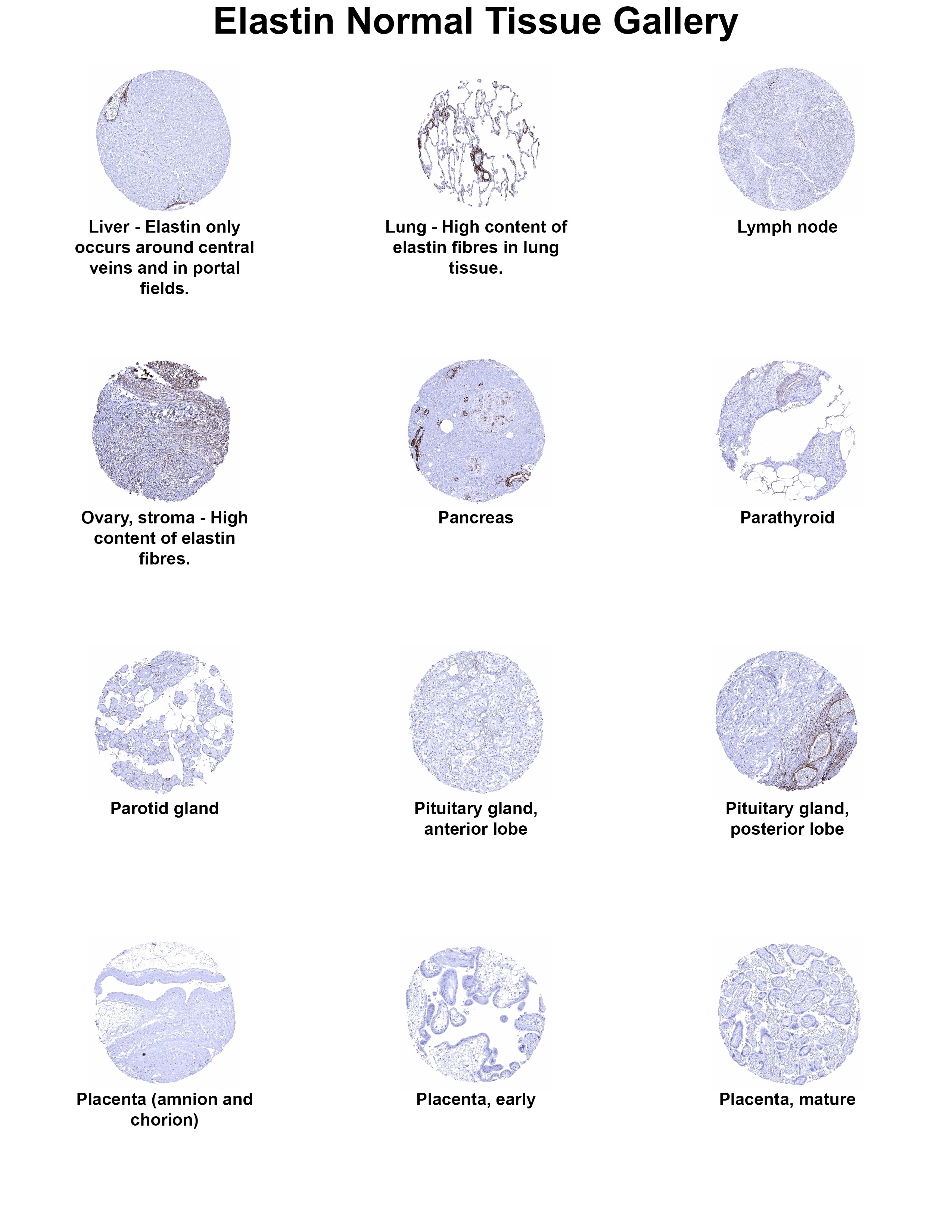 Elastin Antibody (MSVA-648R) Elastin Antibody (MSVA-648R) Elastin Normal Tissue Gallery