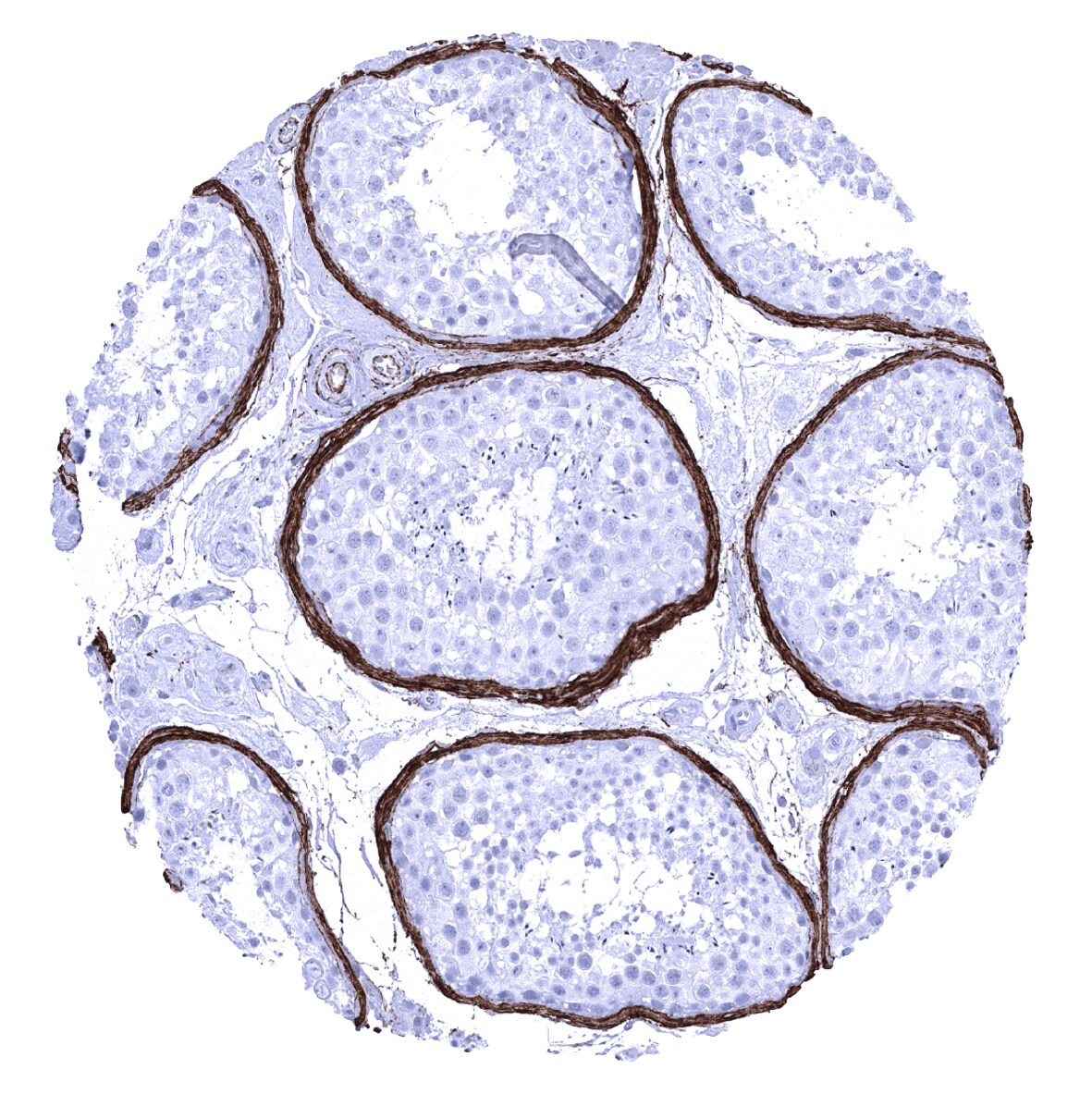 Elastin Antibody (MSVA-648R)