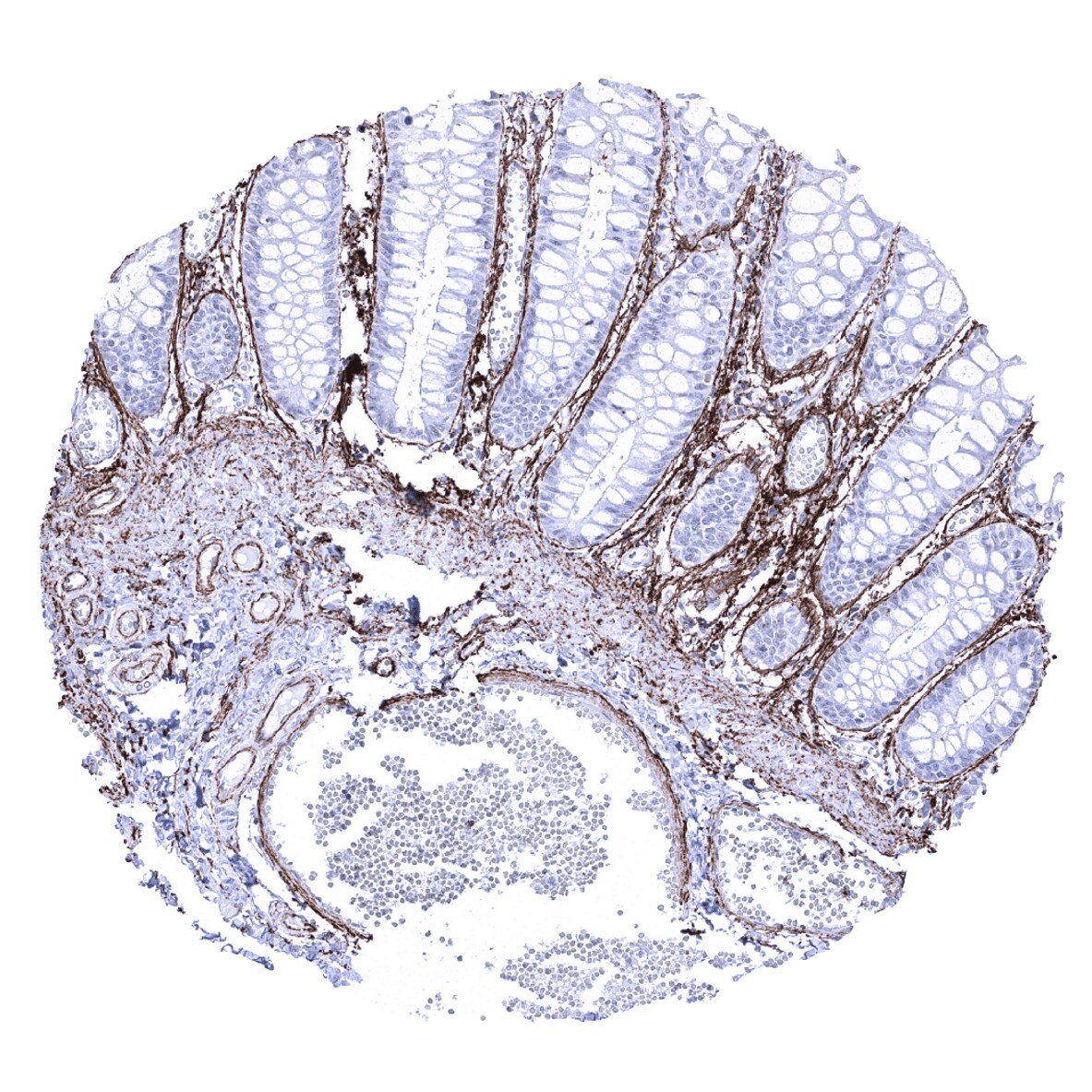 Elastin Antibody (MSVA-648R)