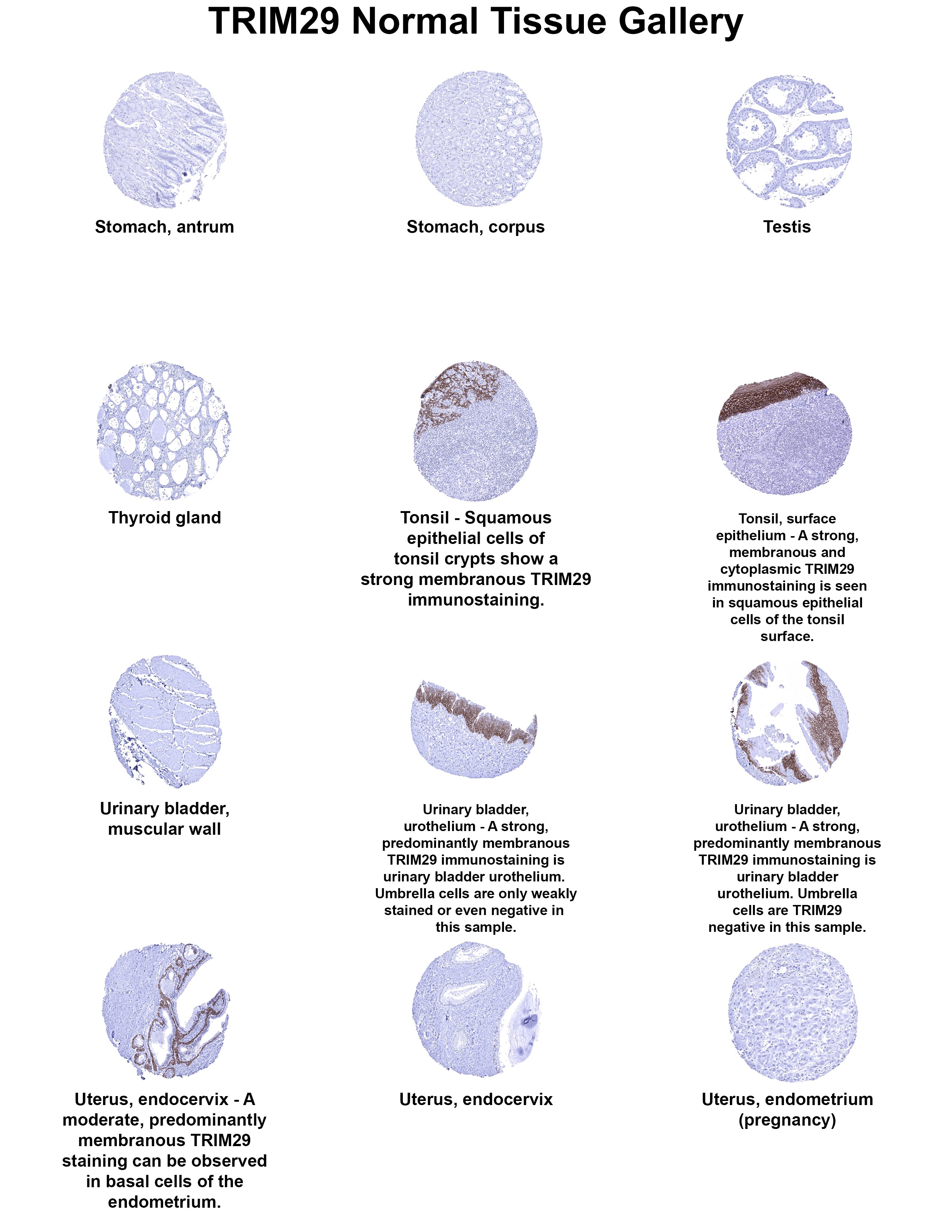 TRIM29 Antibody (MSVA-629M) TRIM29 Antibody (MSVA-629M) TRIM29 Normal Tissue Gallery