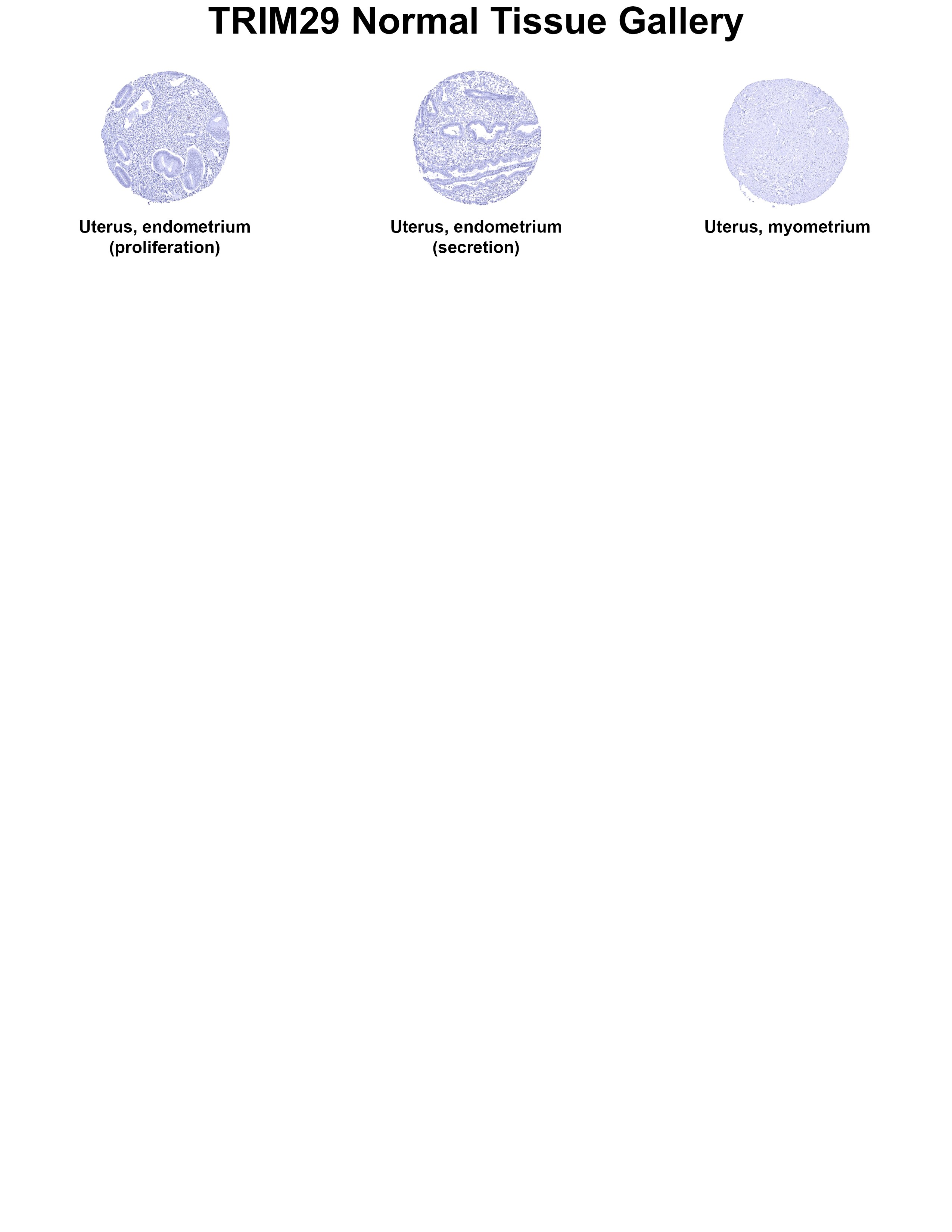 TRIM29 Antibody (MSVA-629M) TRIM29 Antibody (MSVA-629M) TRIM29 Normal Tissue Gallery