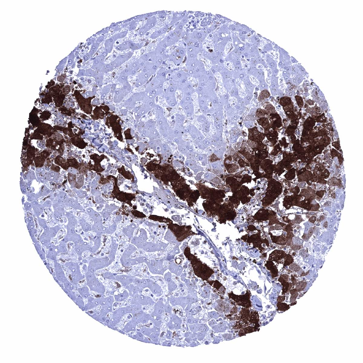 Glutamine Synthetase Antibody (MSVA-750M)