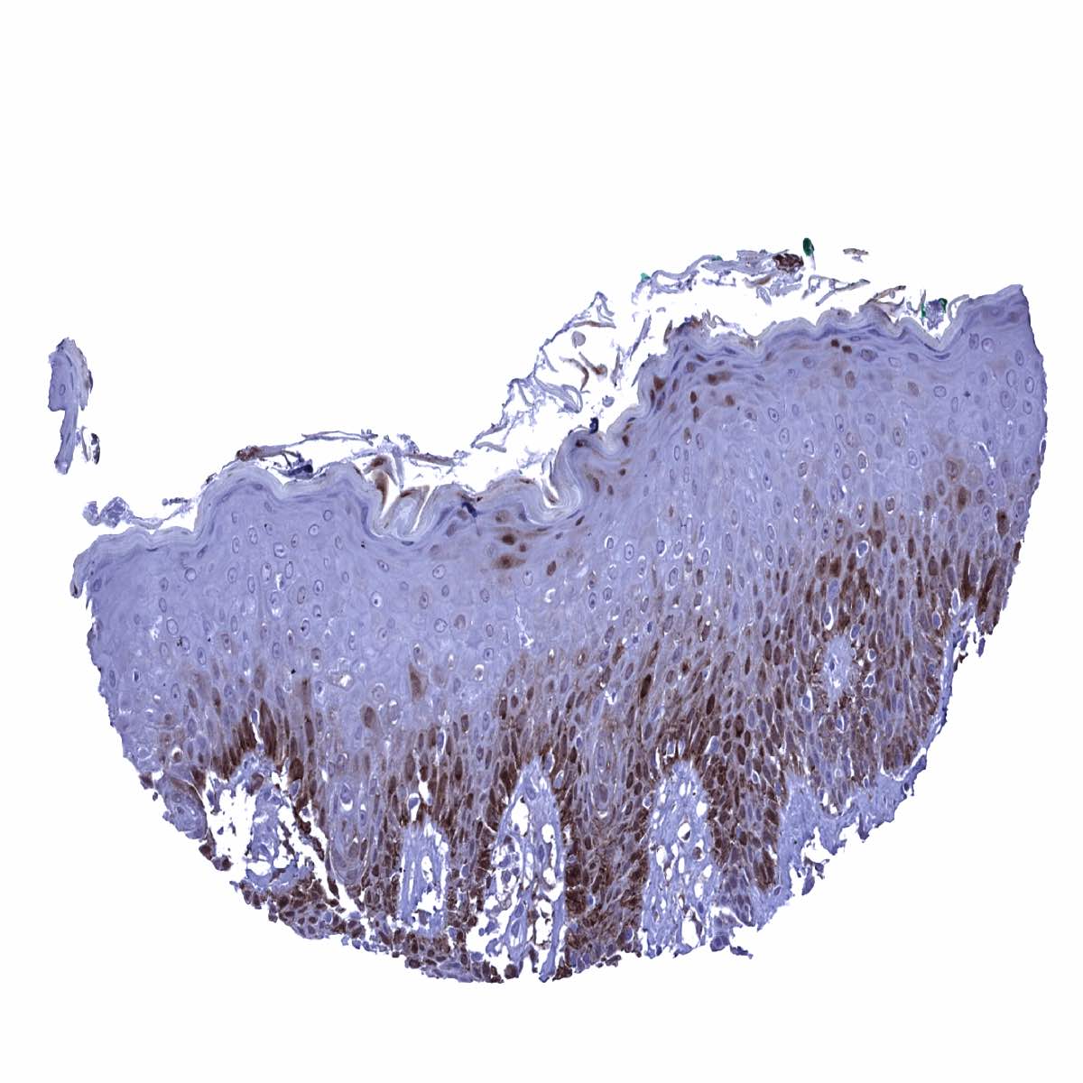 Glutamine Synthetase Antibody (MSVA-750M)