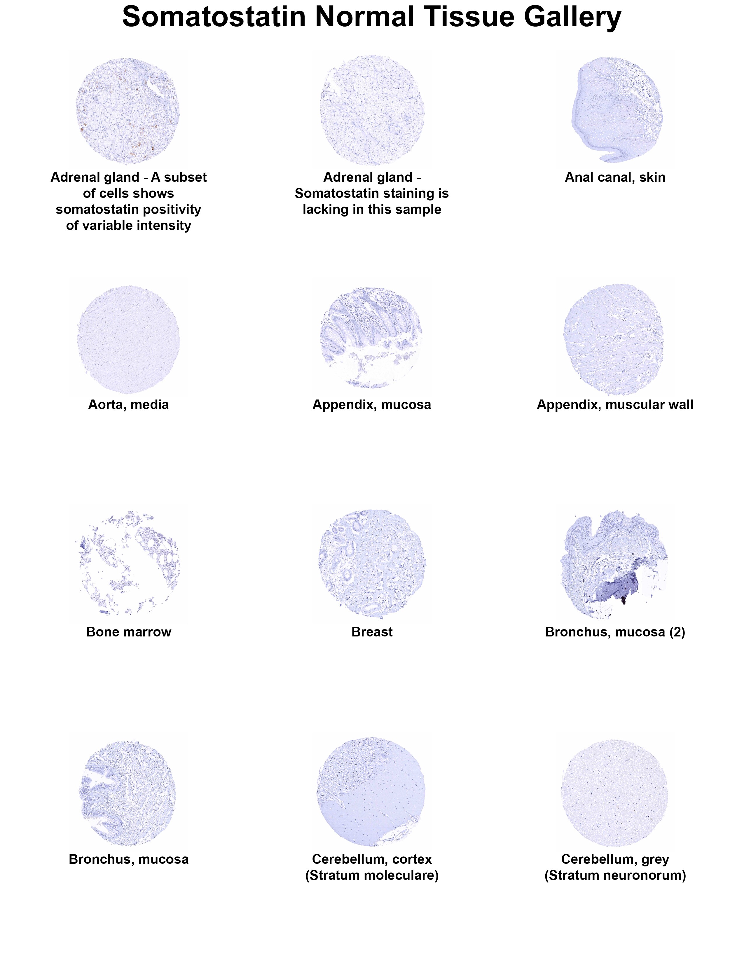 Somatostatin Antibody (MSVA-638R) Somatostatin Antibody (MSVA-638R) Somatostatin Normal Tissue Gallery