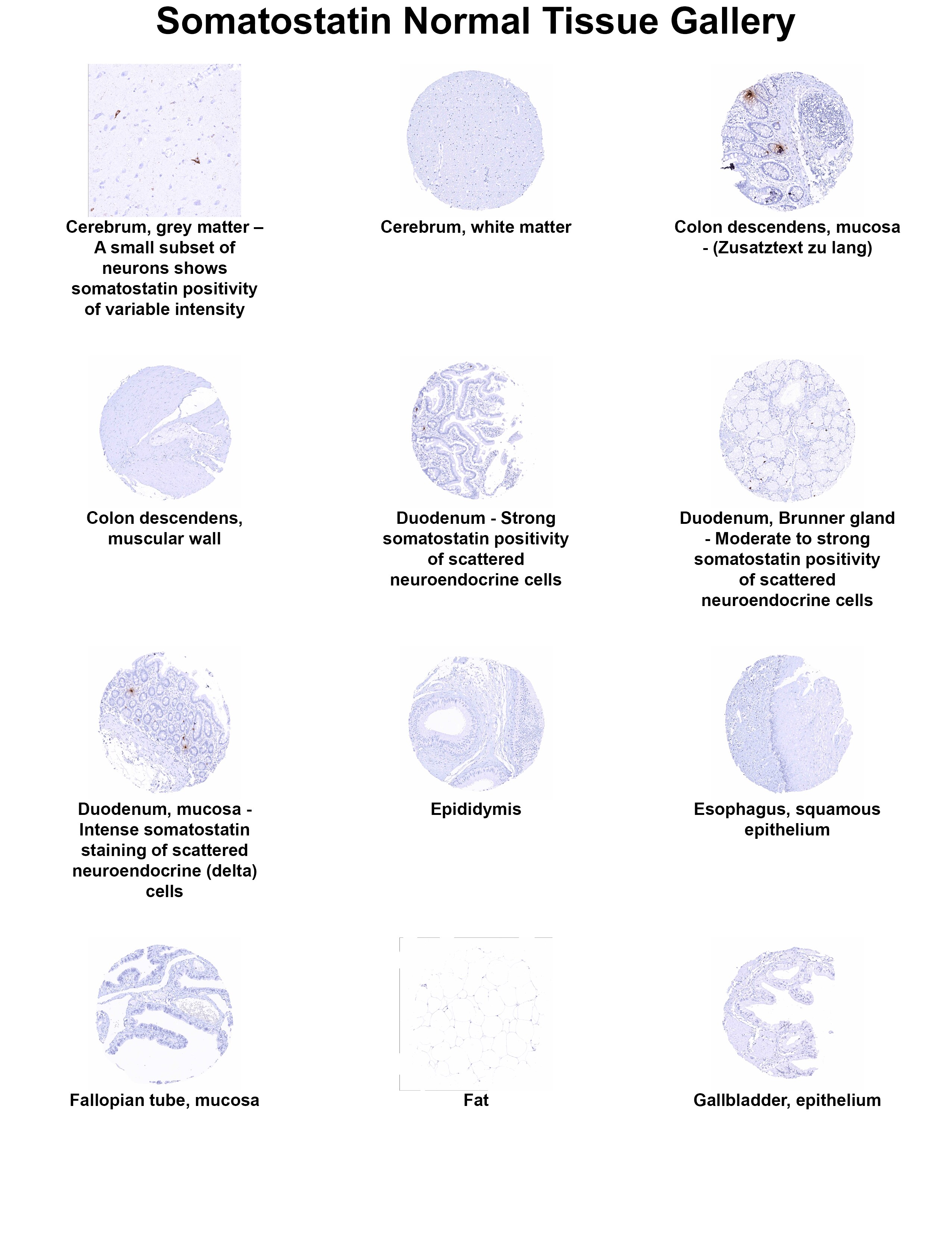 Somatostatin Antibody (MSVA-638R) Somatostatin Antibody (MSVA-638R) Somatostatin Normal Tissue Gallery