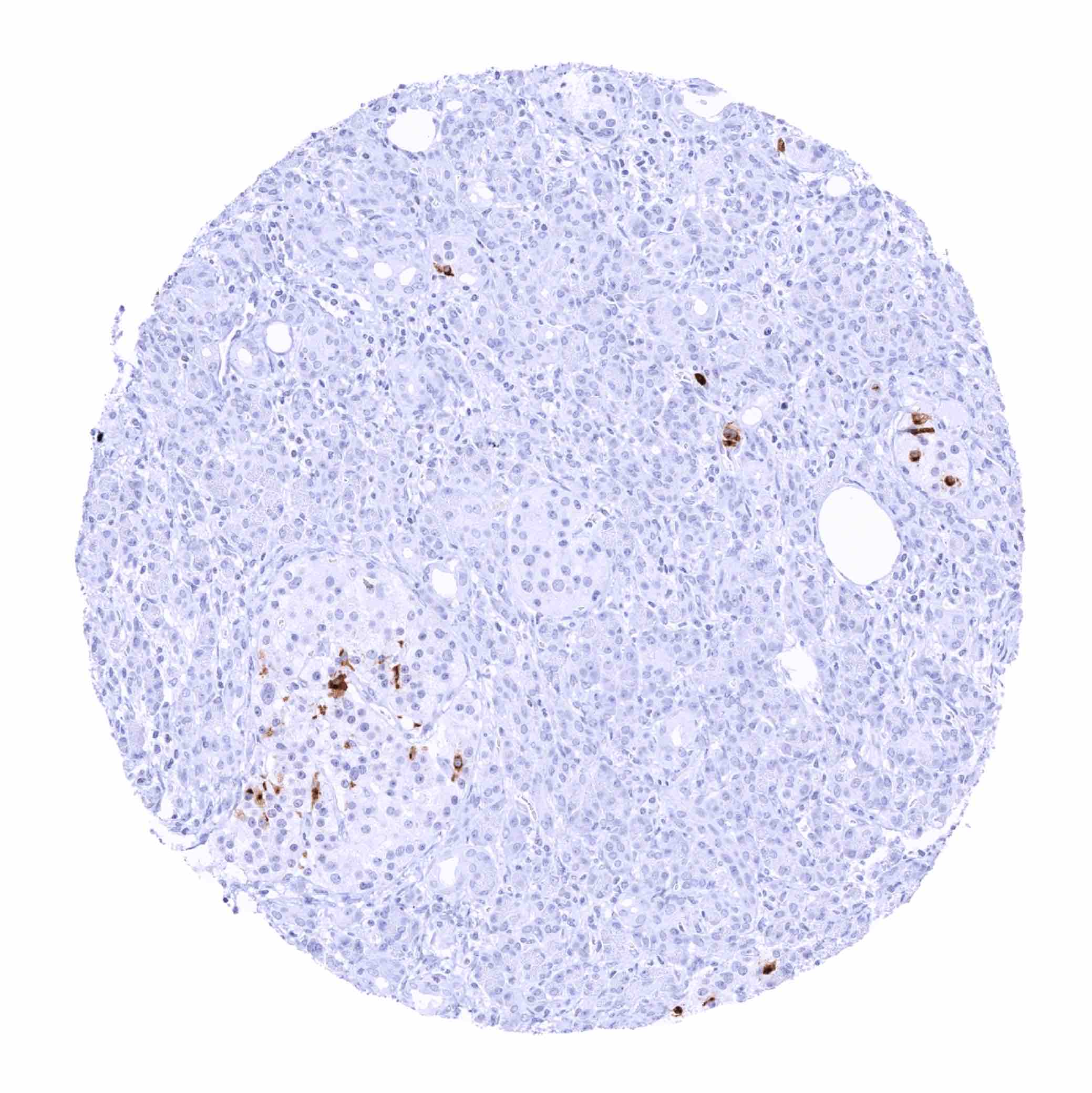 Somatostatin Antibody (MSVA-638R)