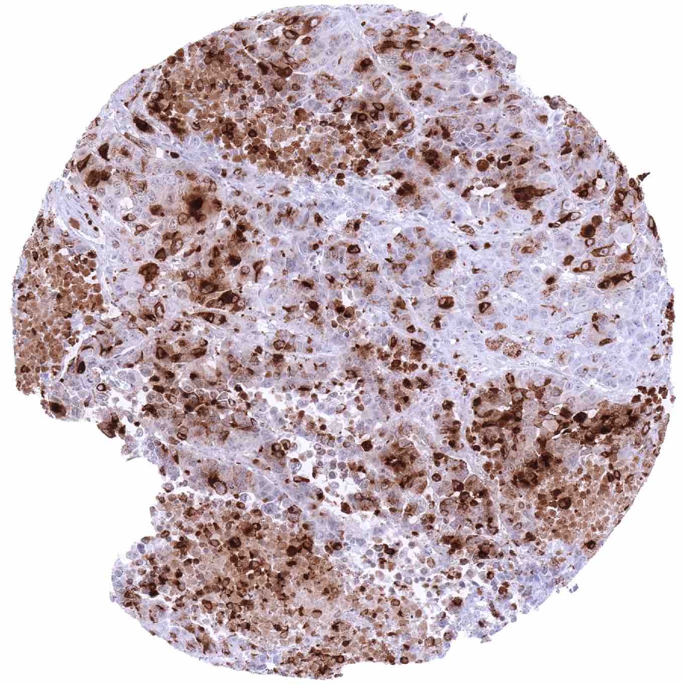 Somatostatin Antibody (MSVA-638R)