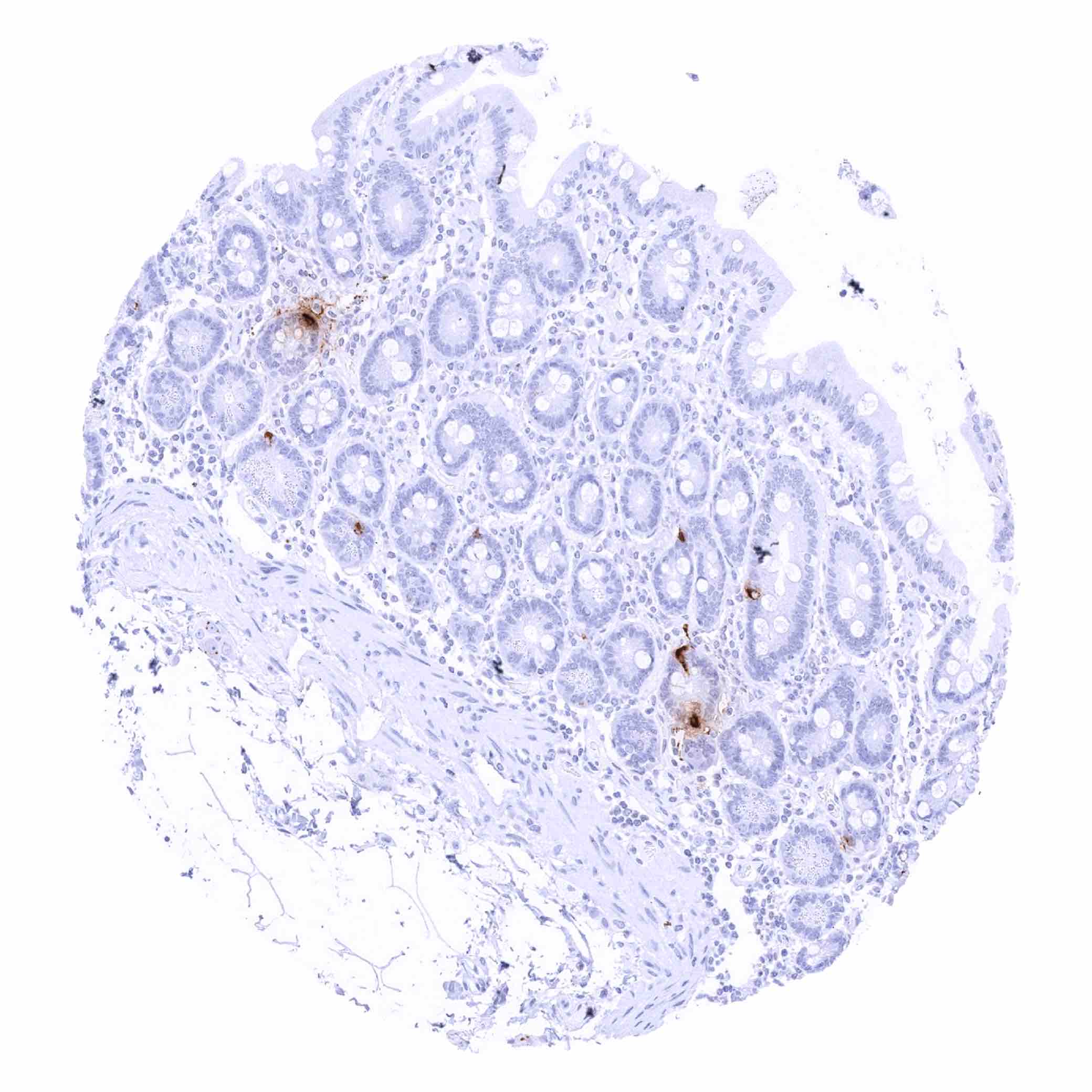 Somatostatin Antibody (MSVA-638R)