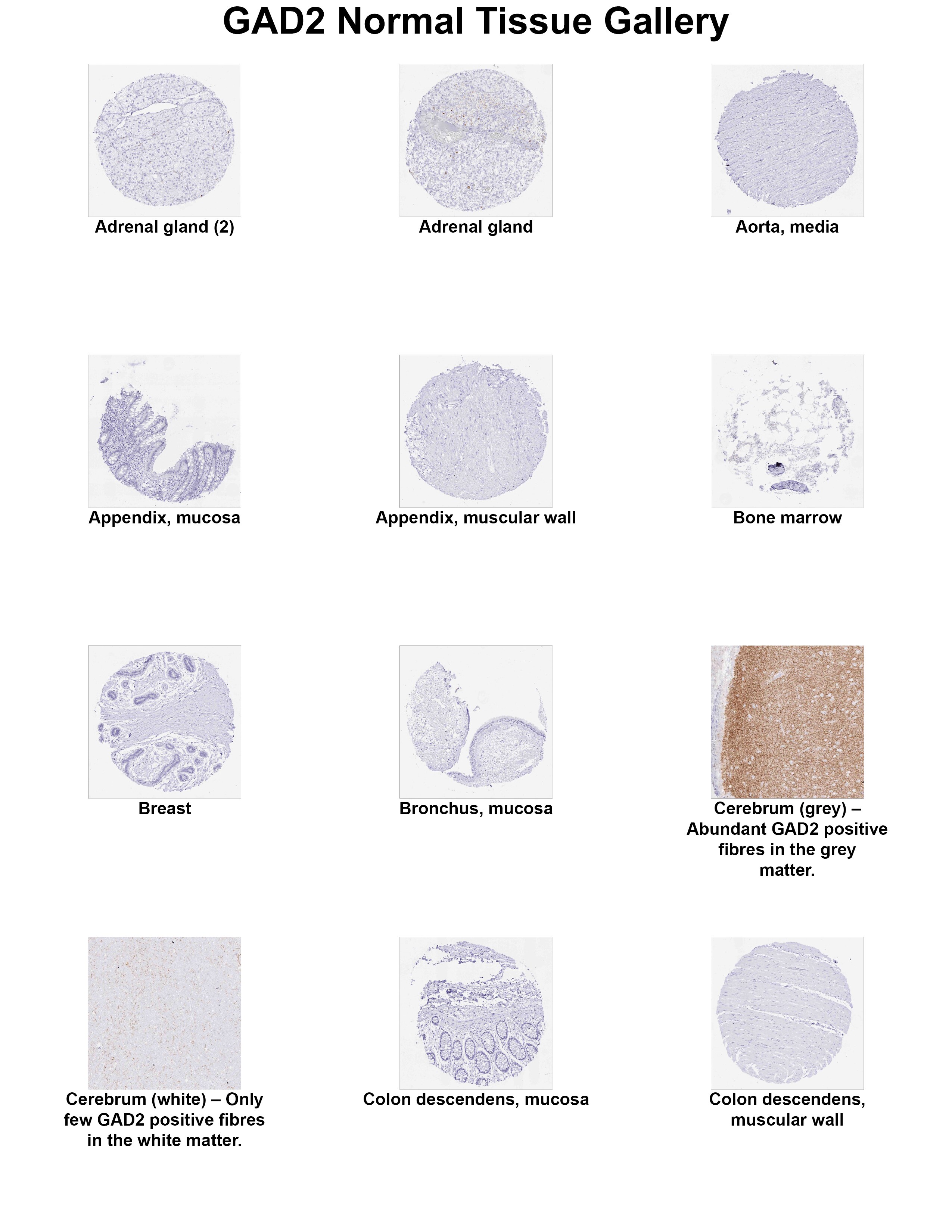 GAD2/GAD65 Antibody (MSVA-602M) GAD2/GAD65 Antibody (MSVA-602M) GAD2/GAD65 Normal Tissue Gallery