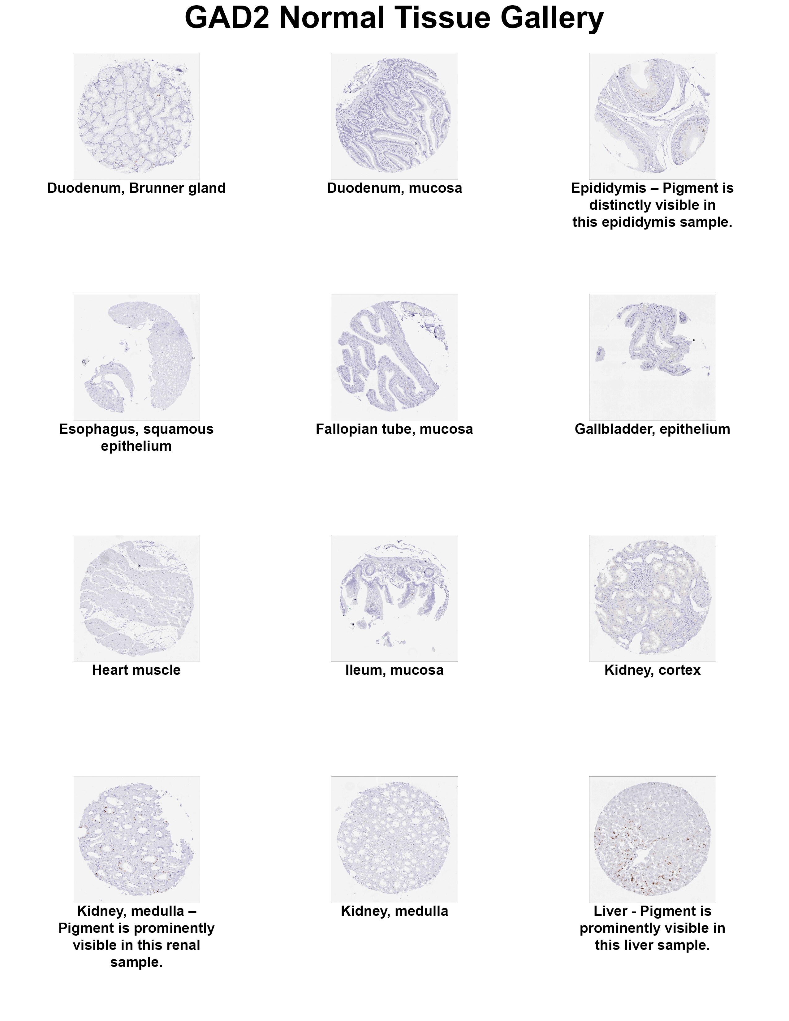 GAD2/GAD65 Antibody (MSVA-602M) GAD2/GAD65 Antibody (MSVA-602M) GAD2/GAD65 Normal Tissue Gallery