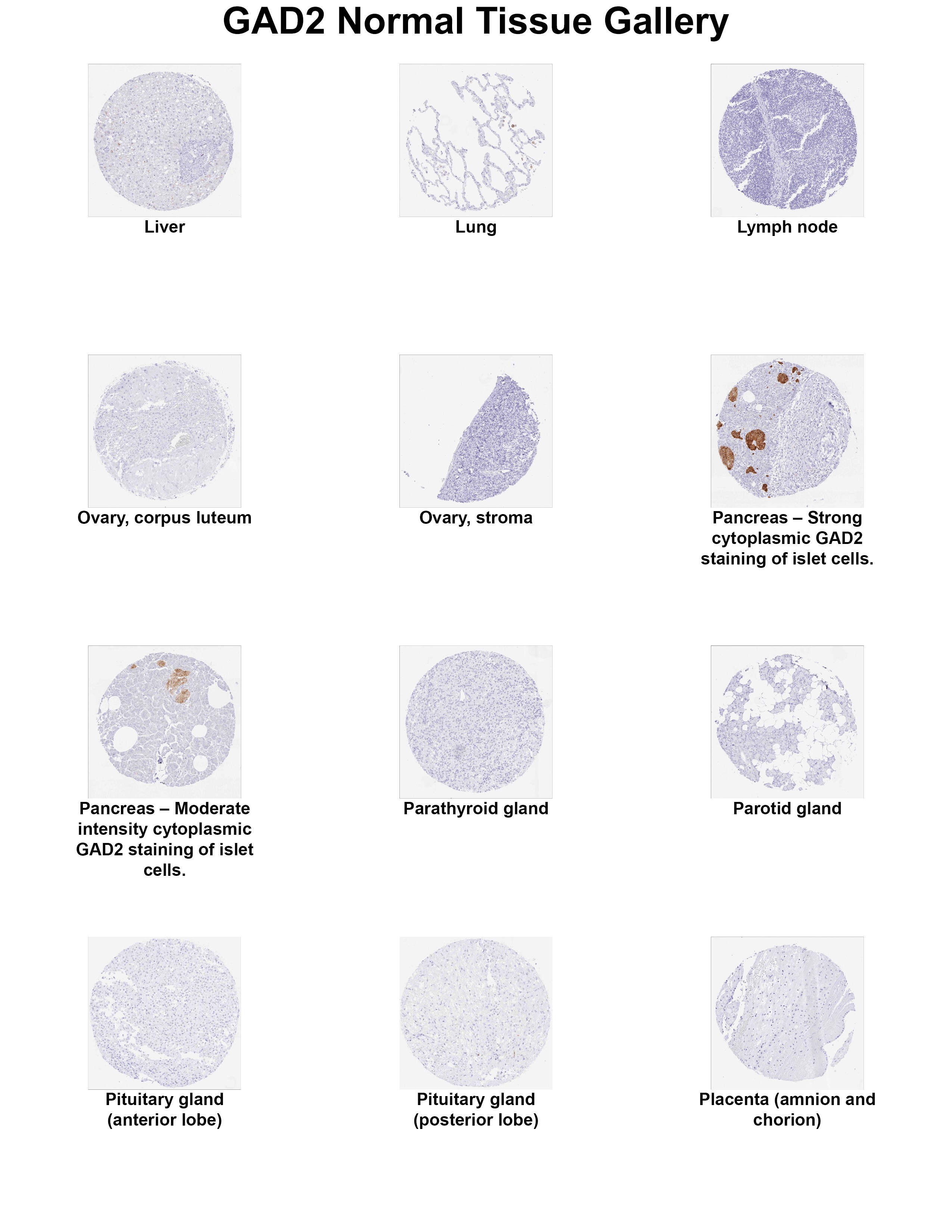 GAD2/GAD65 Antibody (MSVA-602M) GAD2/GAD65 Antibody (MSVA-602M) GAD2/GAD65 Normal Tissue Gallery