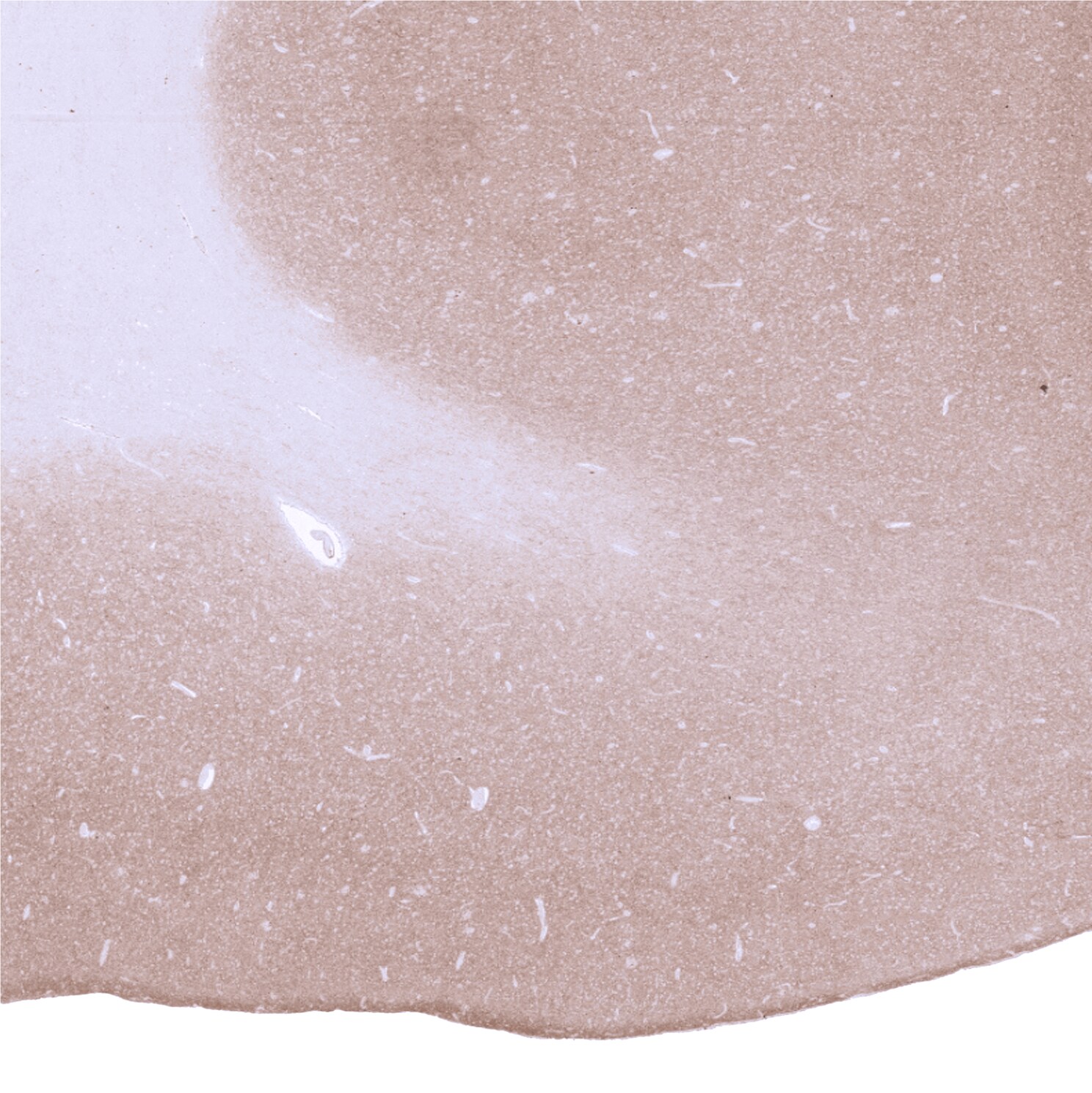 GAD2/GAD65 Antibody (MSVA-602M)