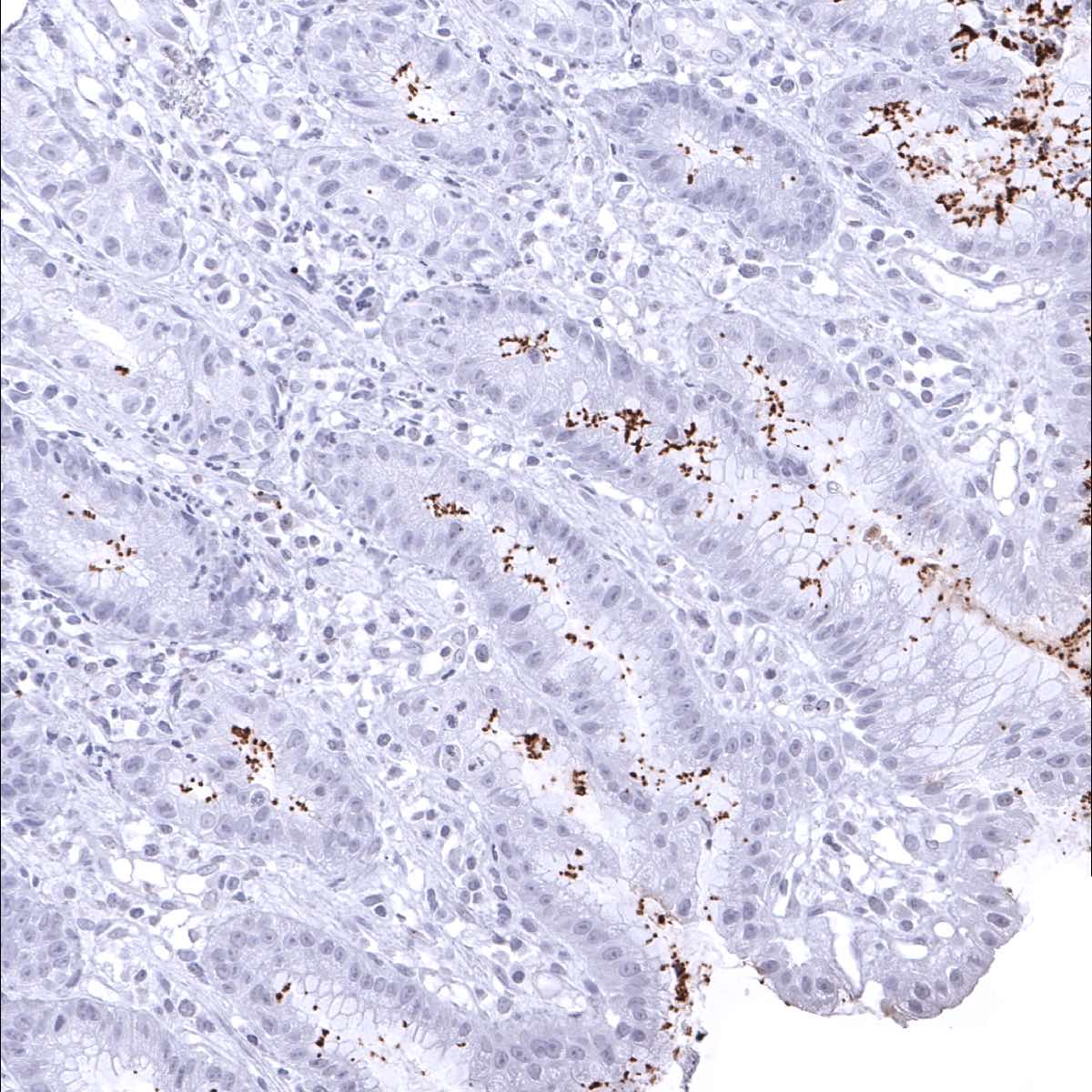 Helicobacter Pylori Antibody (MSVA-466M)