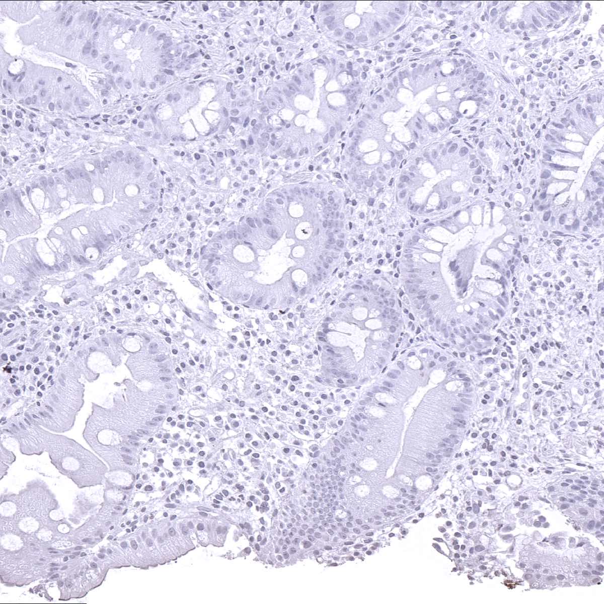 Helicobacter Pylori Antibody (MSVA-466M)