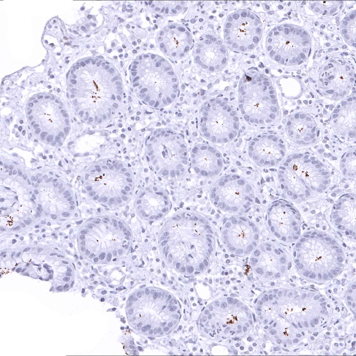 Helicobacter Pylori Antibody (MSVA-466M)