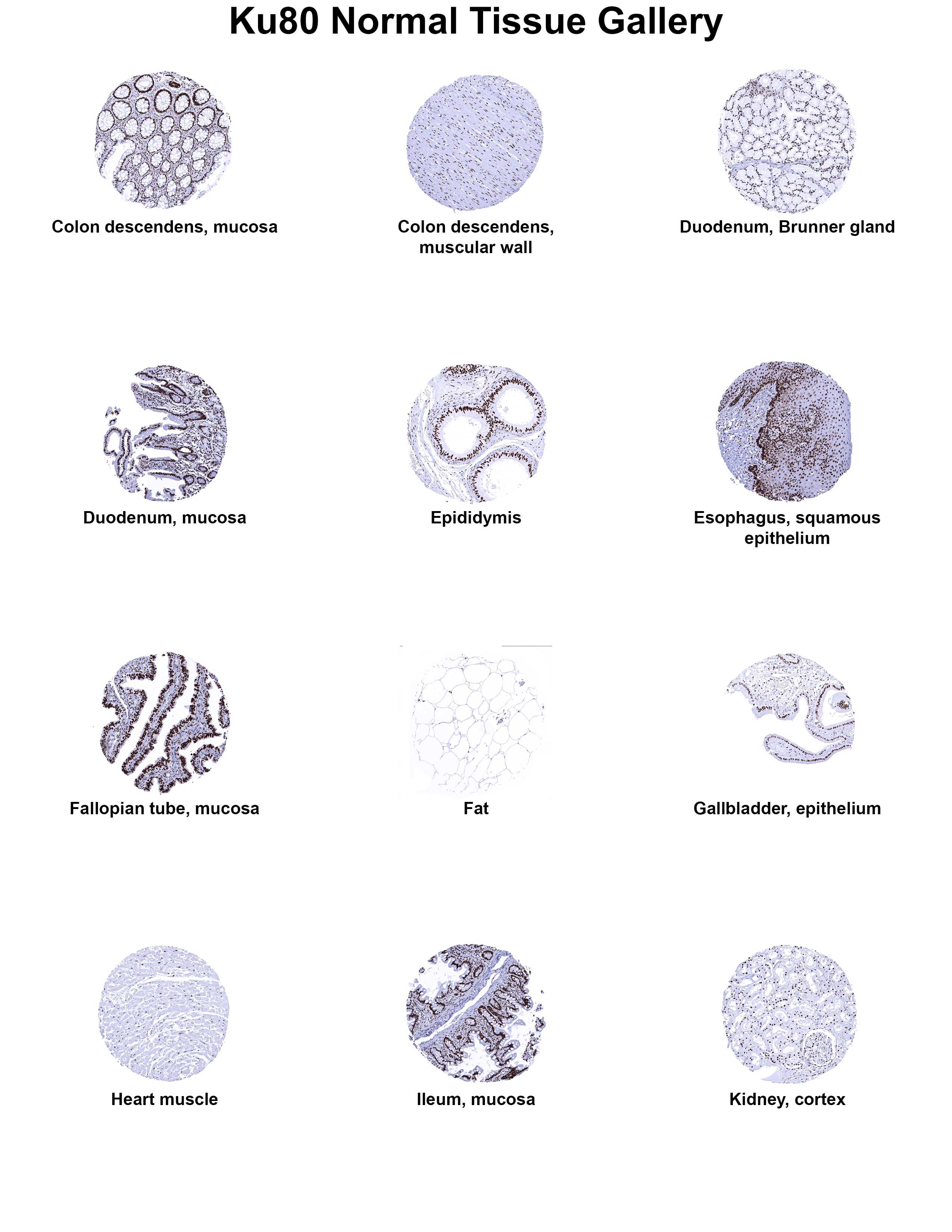 Ku80/XRCC5 Antibody (MSVA-880M) Ku80/XRCC5 Antibody (MSVA-880M) Ku80/XRCC5 Normal Tissue Gallery