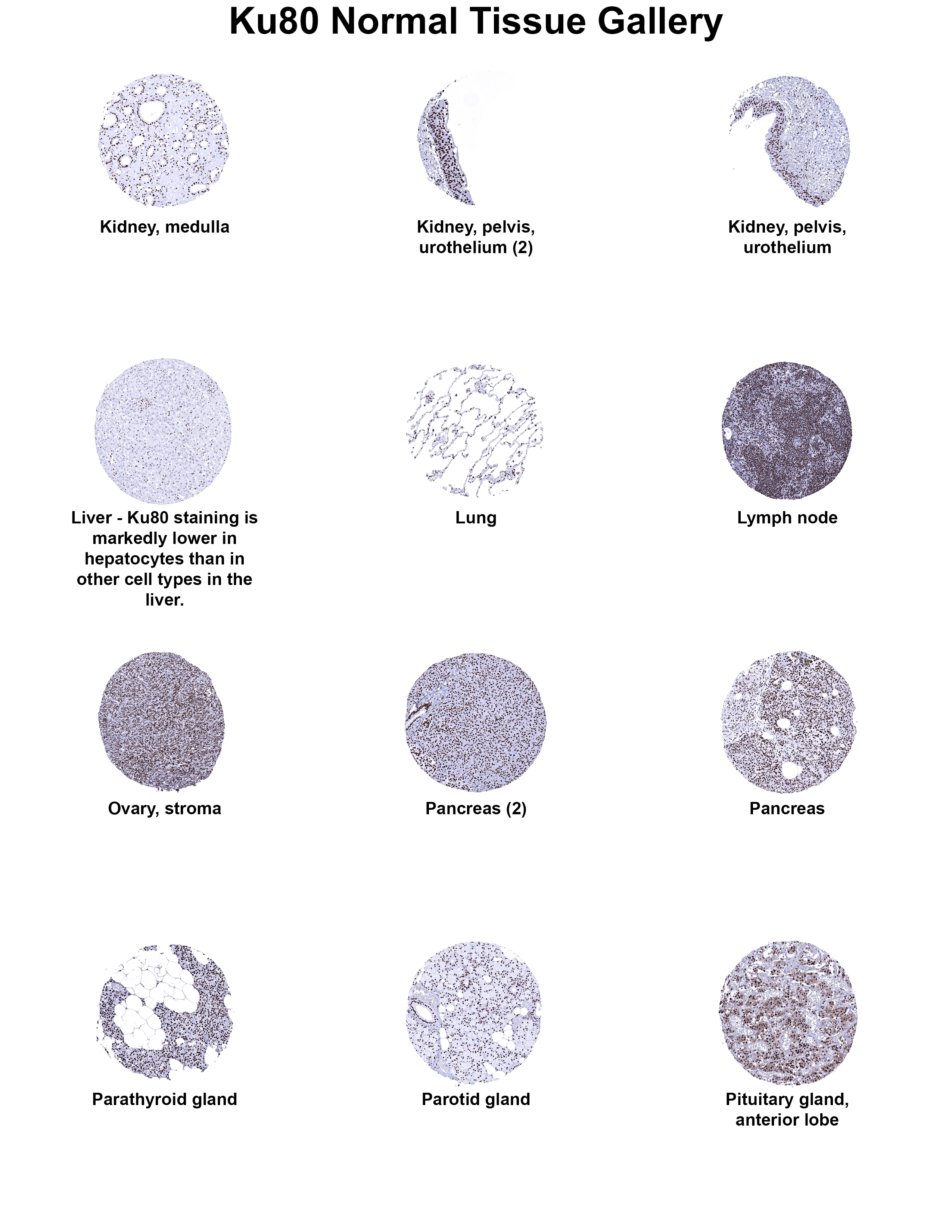 Ku80/XRCC5 Antibody (MSVA-880M) Ku80/XRCC5 Antibody (MSVA-880M) Ku80/XRCC5 Normal Tissue Gallery