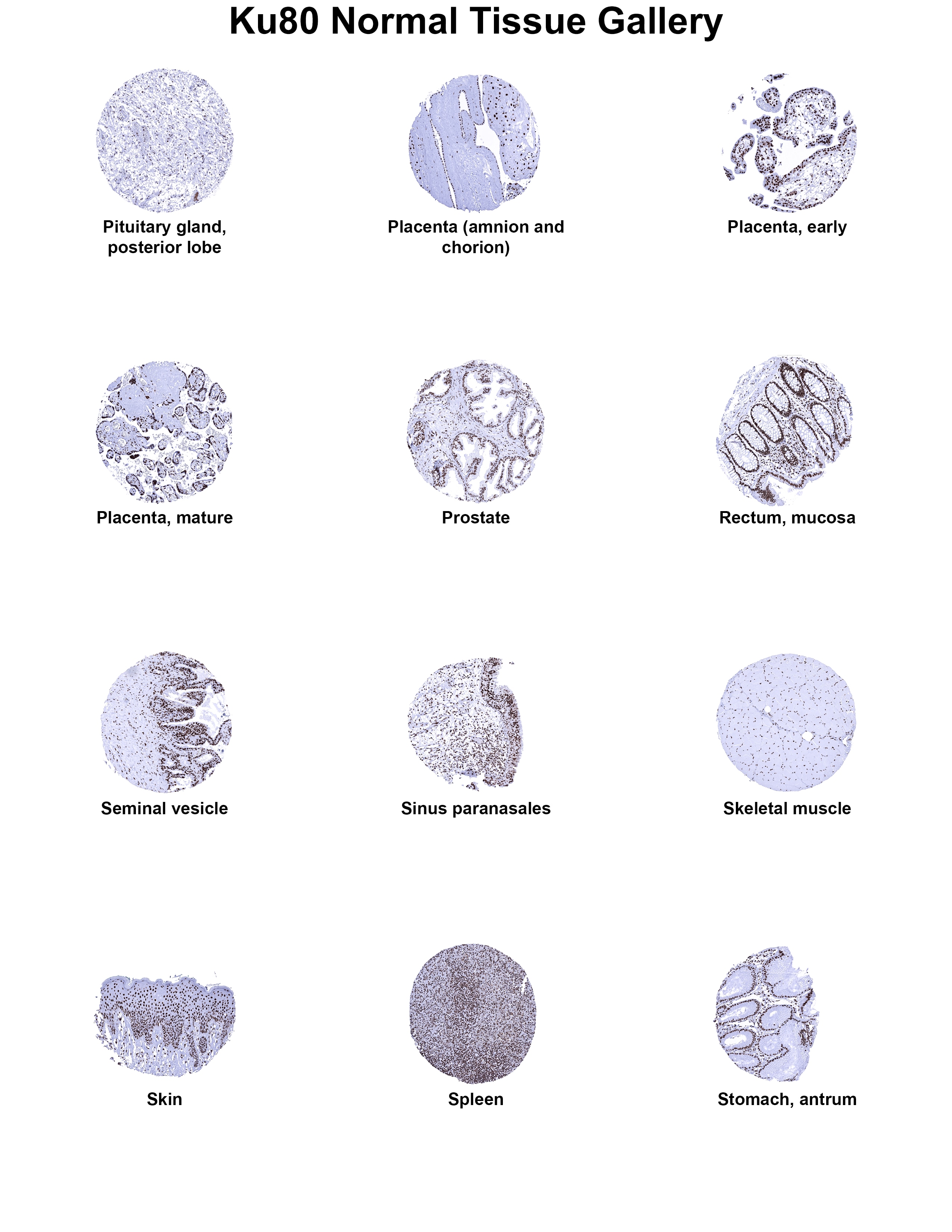 Ku80/XRCC5 Antibody (MSVA-880M) Ku80/XRCC5 Antibody (MSVA-880M) Ku80/XRCC5 Normal Tissue Gallery