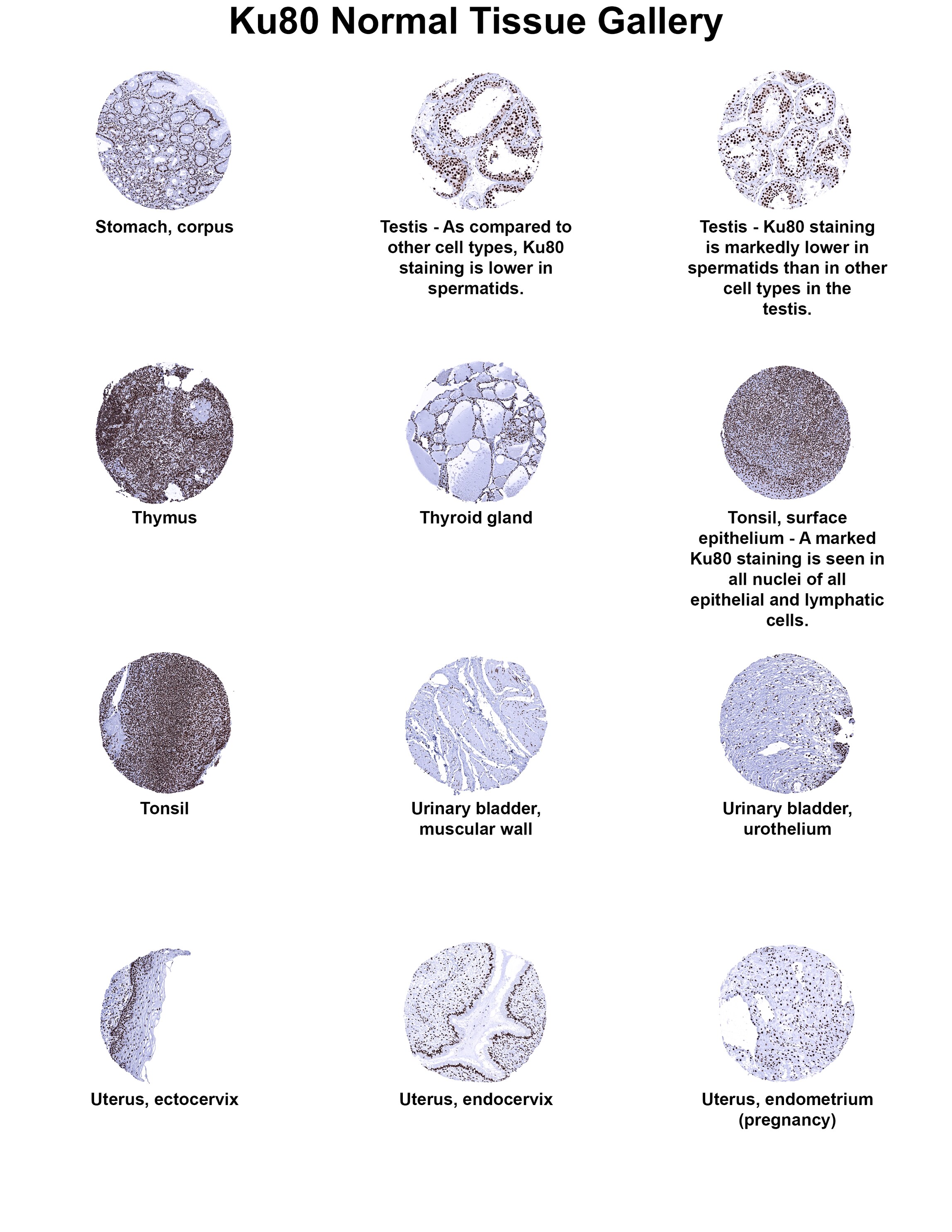 Ku80/XRCC5 Antibody (MSVA-880M) Ku80/XRCC5 Antibody (MSVA-880M) Ku80/XRCC5 Normal Tissue Gallery