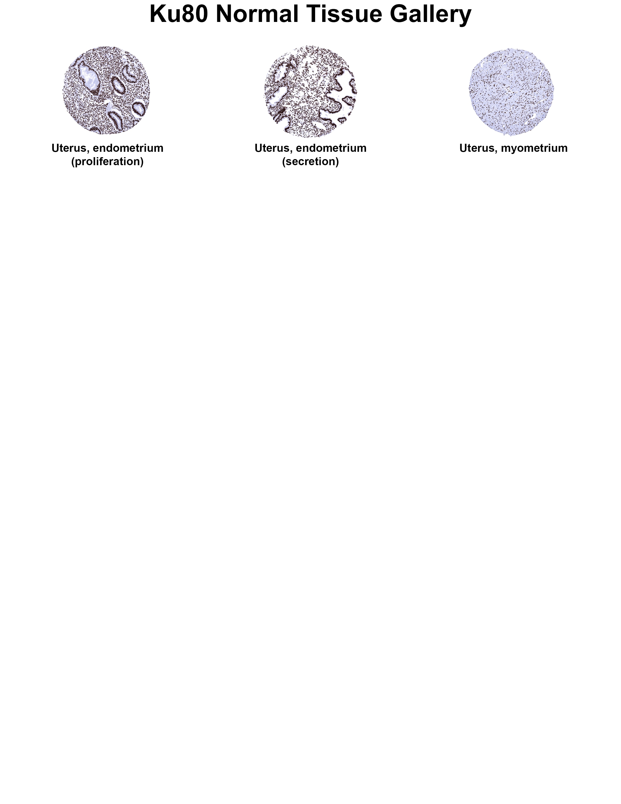 Ku80/XRCC5 Antibody (MSVA-880M) Ku80/XRCC5 Antibody (MSVA-880M) Ku80/XRCC5 Normal Tissue Gallery