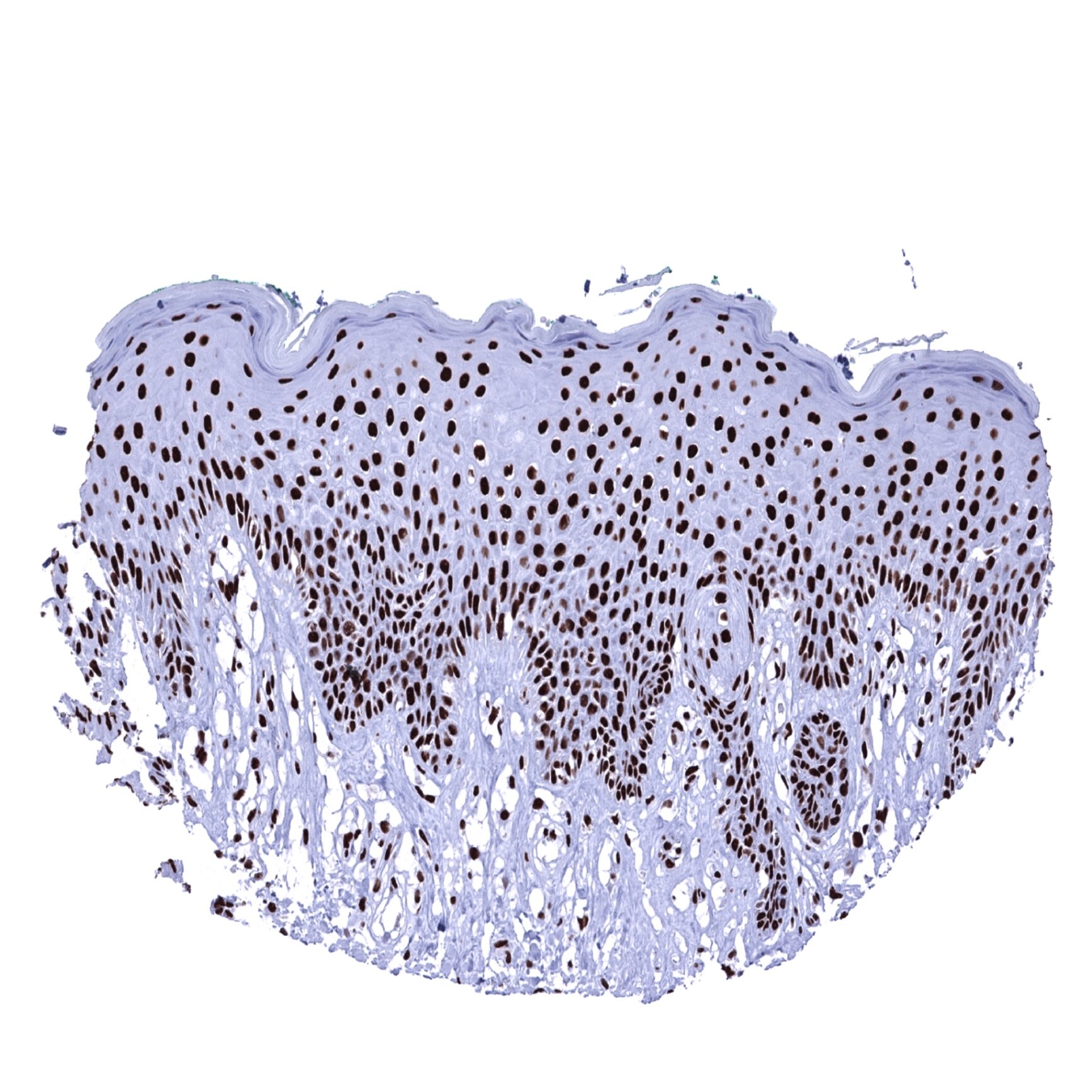 Ku80/XRCC5 Antibody (MSVA-880M)