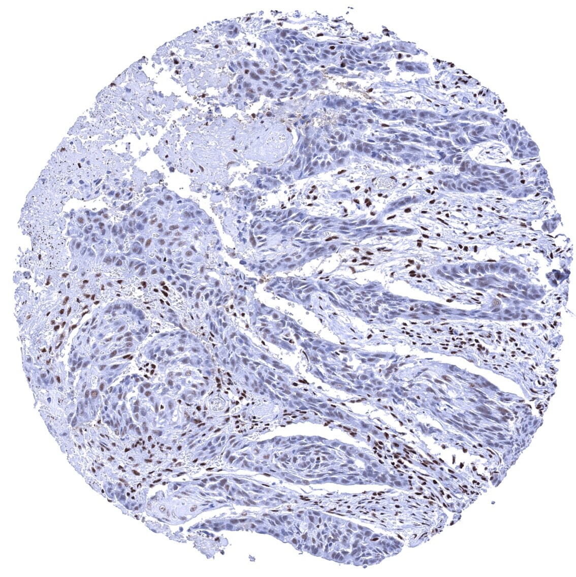 Ku80/XRCC5 Antibody (MSVA-880M)