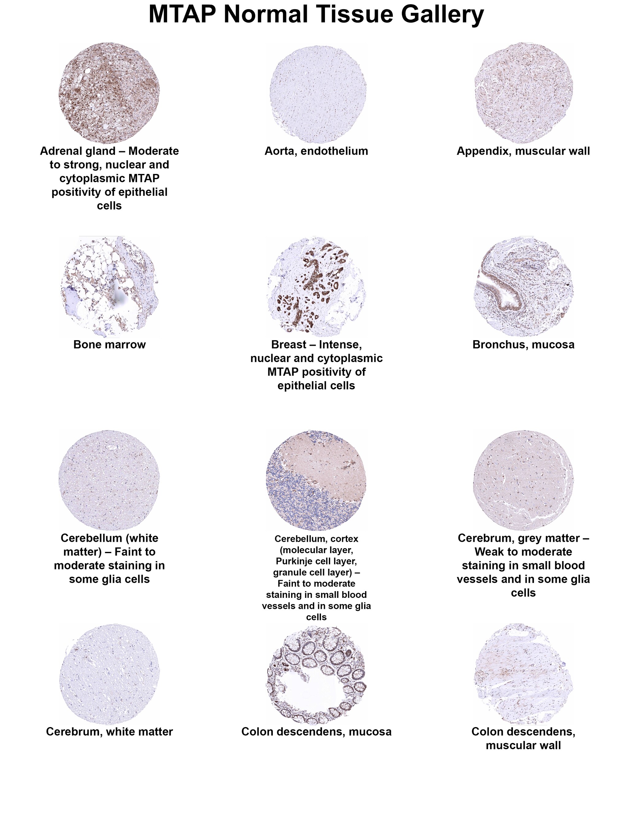 MTAP Antibody (MSVA-741R) MTAP Antibody (MSVA-741R) MTAP Normal Tissue Gallery