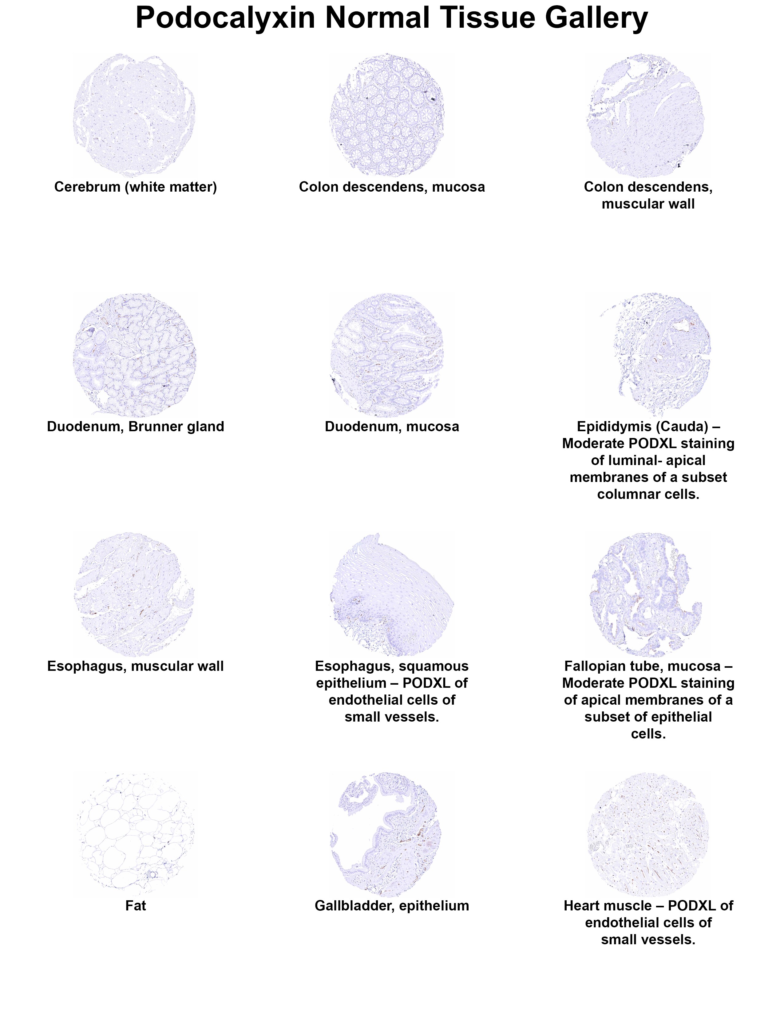 Podocalyxin Like Antibody (MSVA-645M) Podocalyxin Like Antibody (MSVA-645M) Podocalyxin Like Normal Tissue Gallery