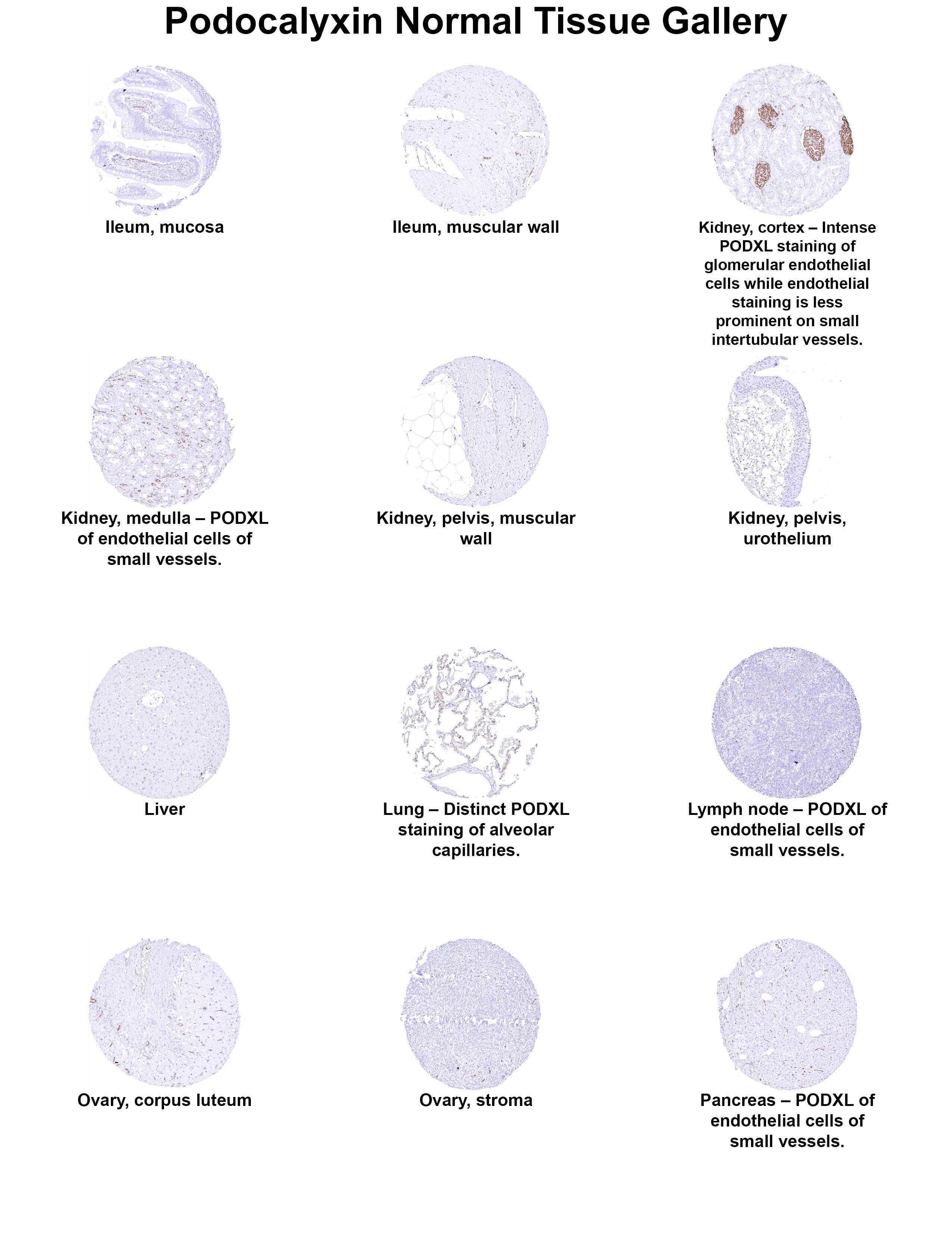 Podocalyxin Like Antibody (MSVA-645M) Podocalyxin Like Antibody (MSVA-645M) Podocalyxin Like Normal Tissue Gallery