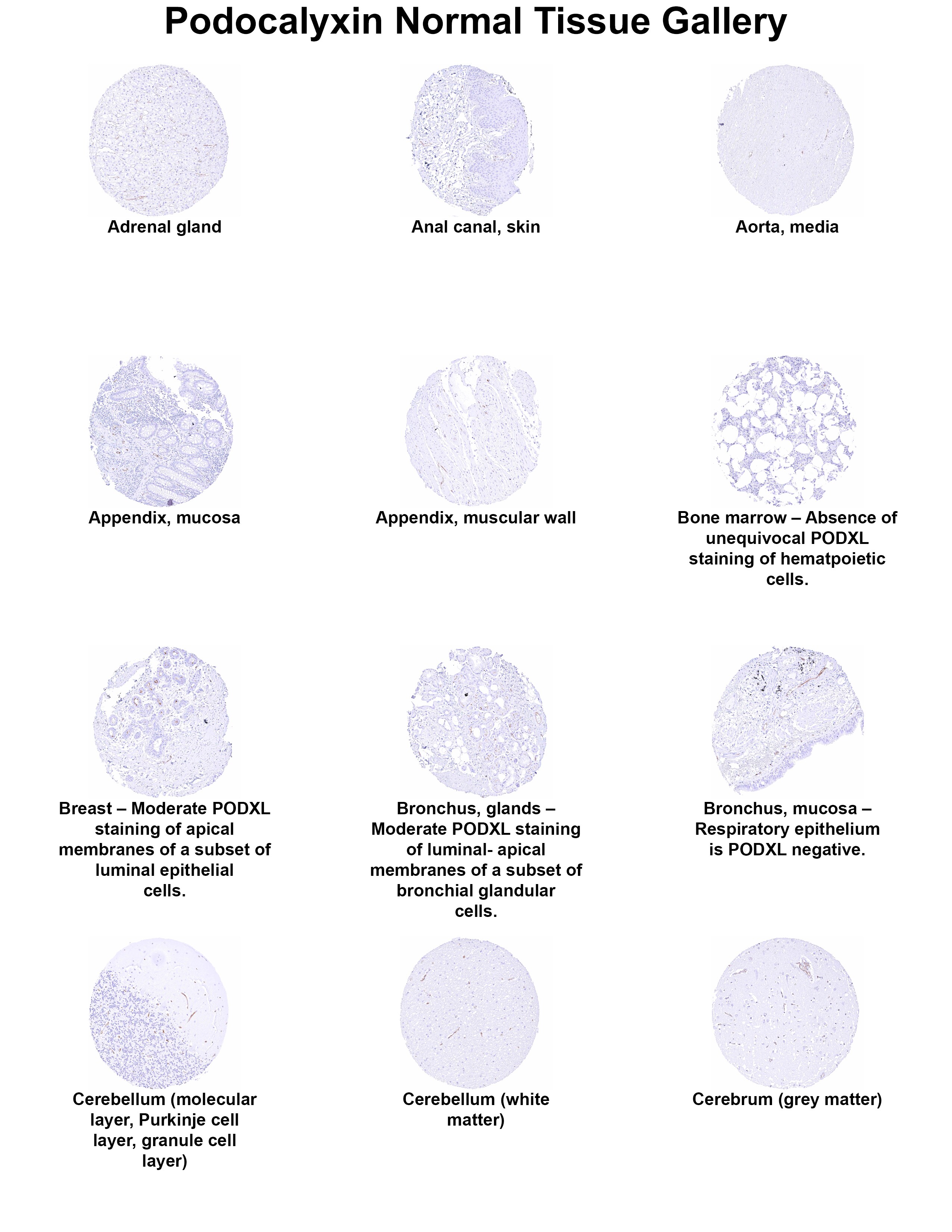 Podocalyxin Like Antibody (MSVA-645M) Podocalyxin Like Antibody (MSVA-645M) Podocalyxin Like Normal Tissue Gallery