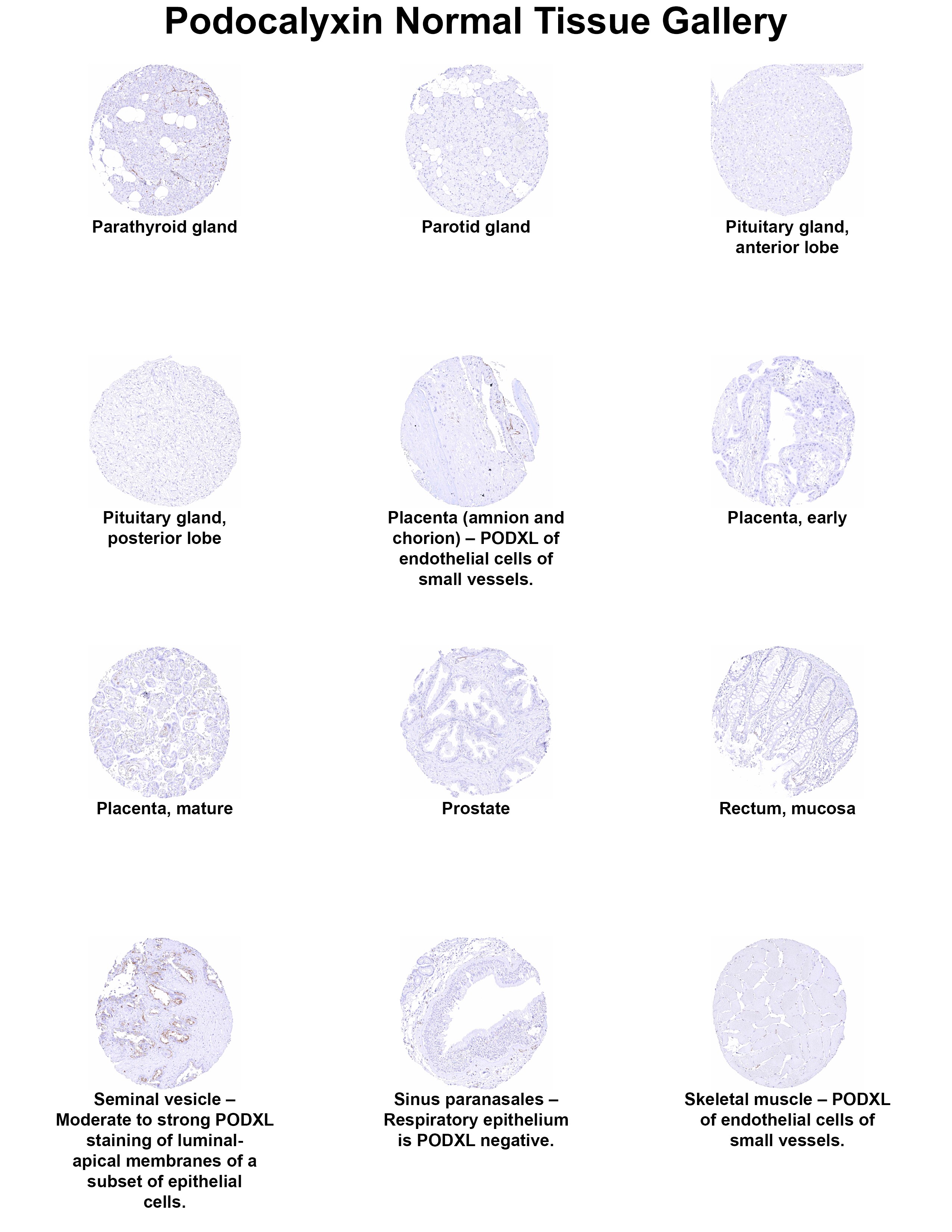 Podocalyxin Like Antibody (MSVA-645M) Podocalyxin Like Antibody (MSVA-645M) Podocalyxin Like Normal Tissue Gallery