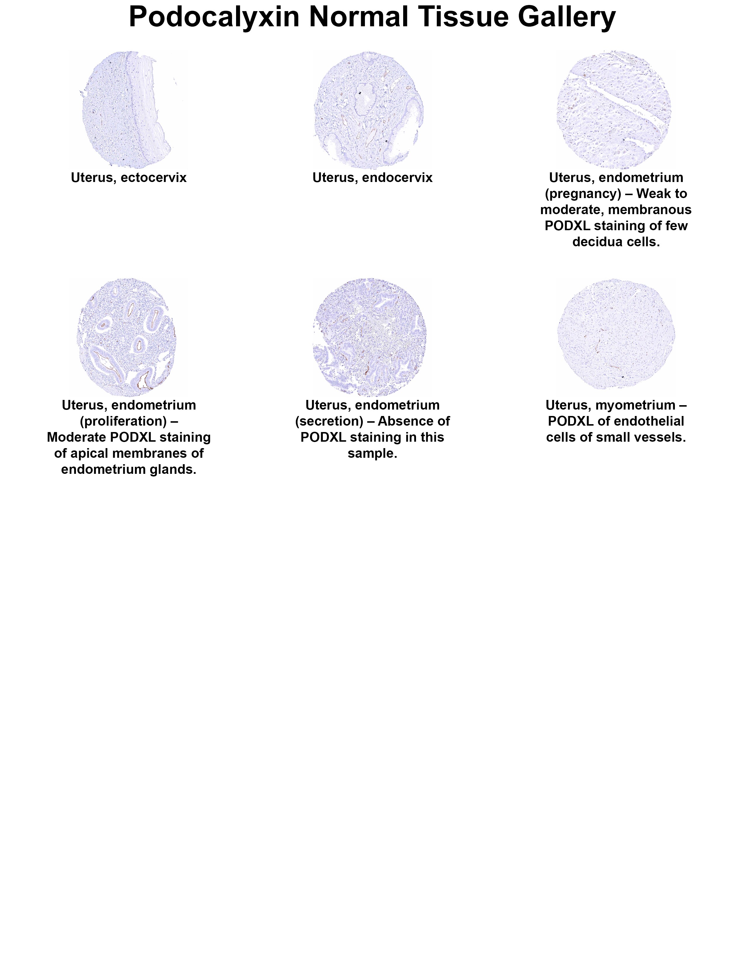 Podocalyxin Like Antibody (MSVA-645M) Podocalyxin Like Antibody (MSVA-645M) Podocalyxin Like Normal Tissue Gallery