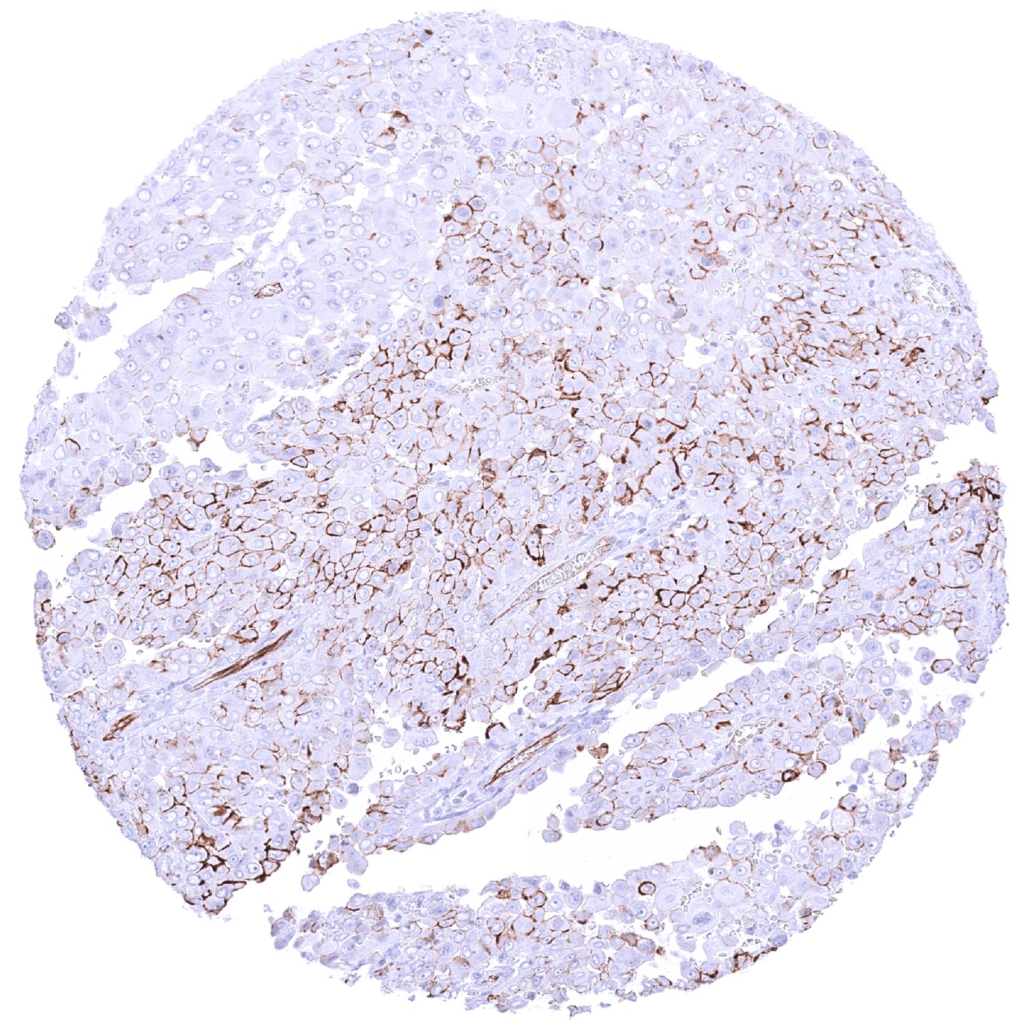 Podocalyxin Like Antibody (MSVA-645M)