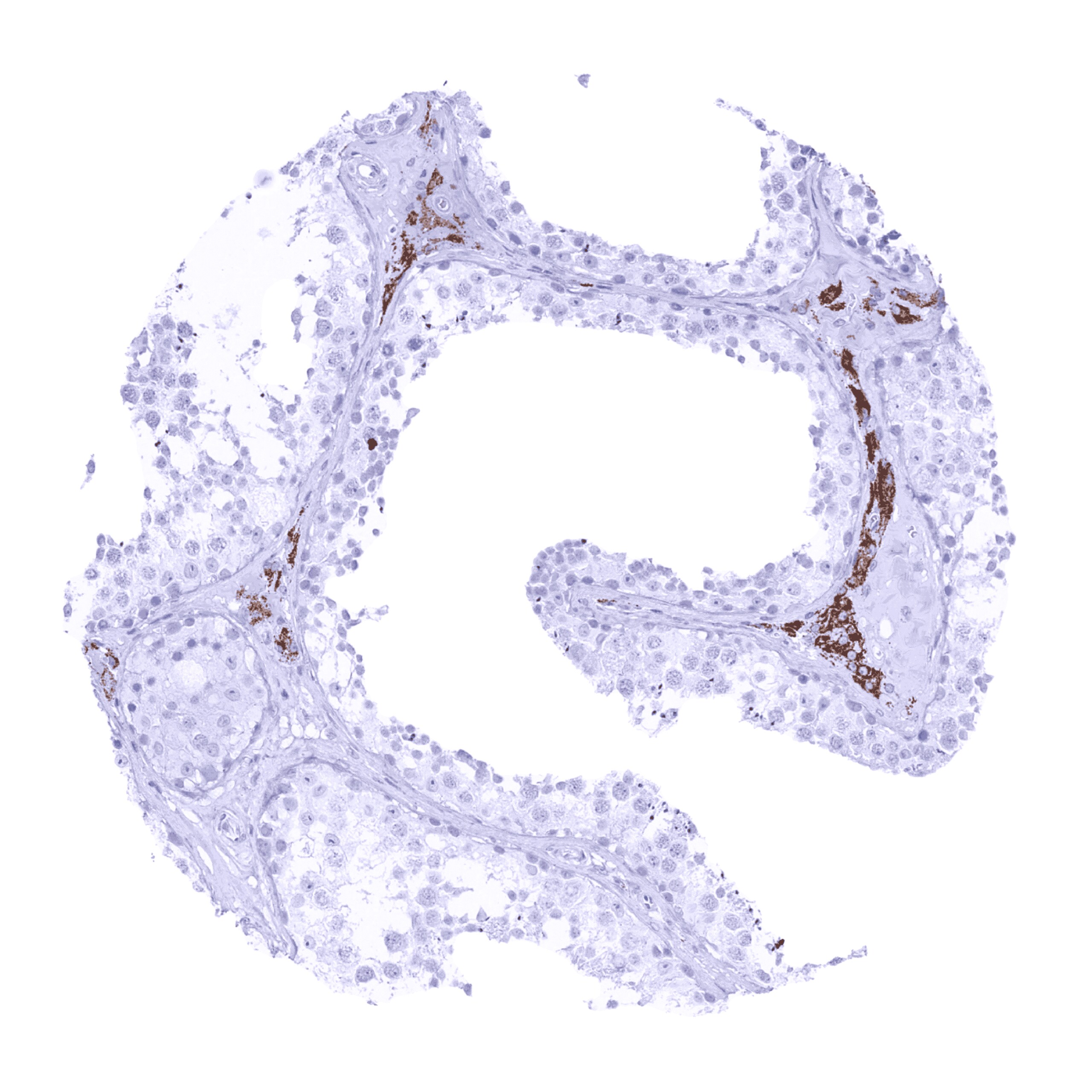 StAR Antibody (MSVA-740R)