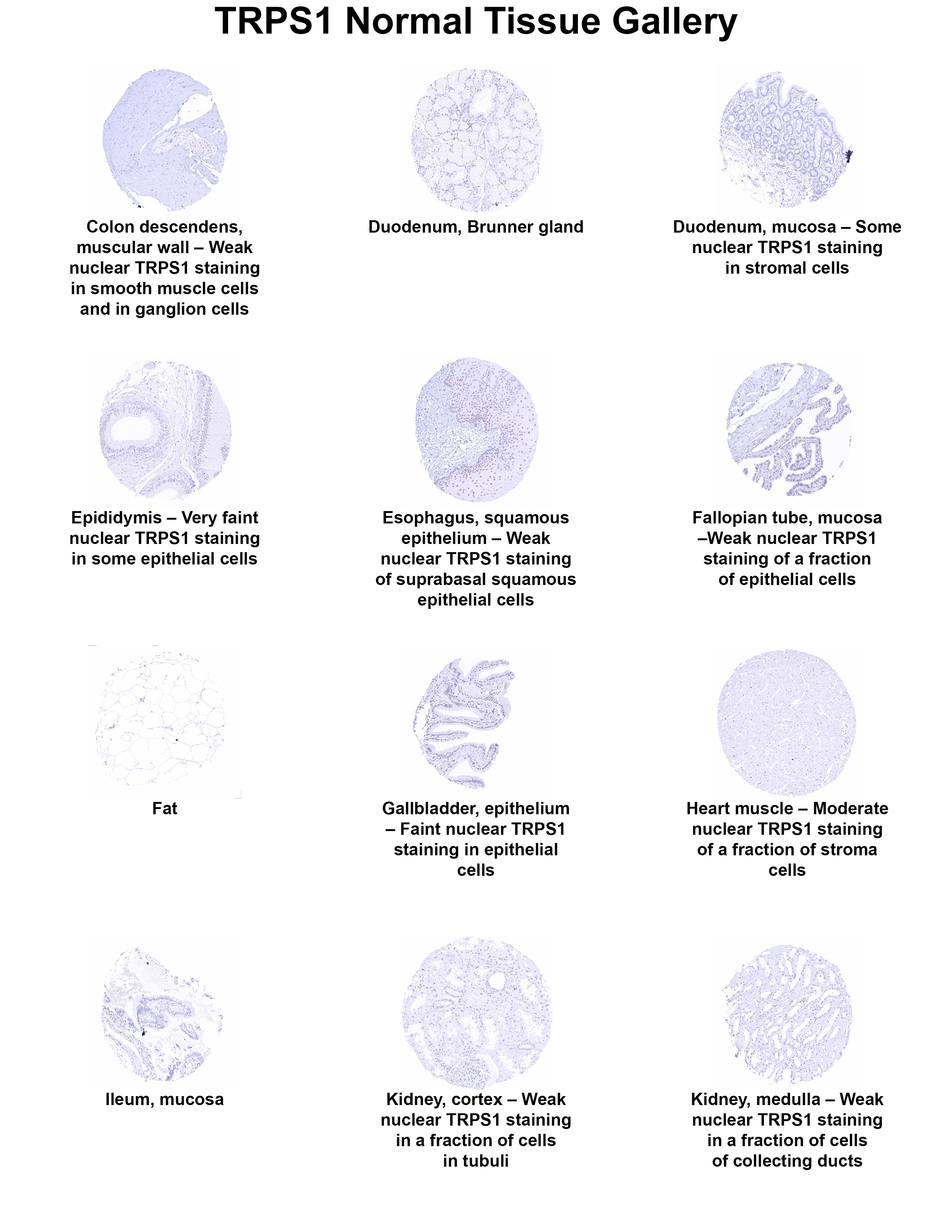 TRPS1 Antibody (MSVA-512R) TRPS1 Antibody (MSVA-512R) TRPS1 Normal Tissue Gallery