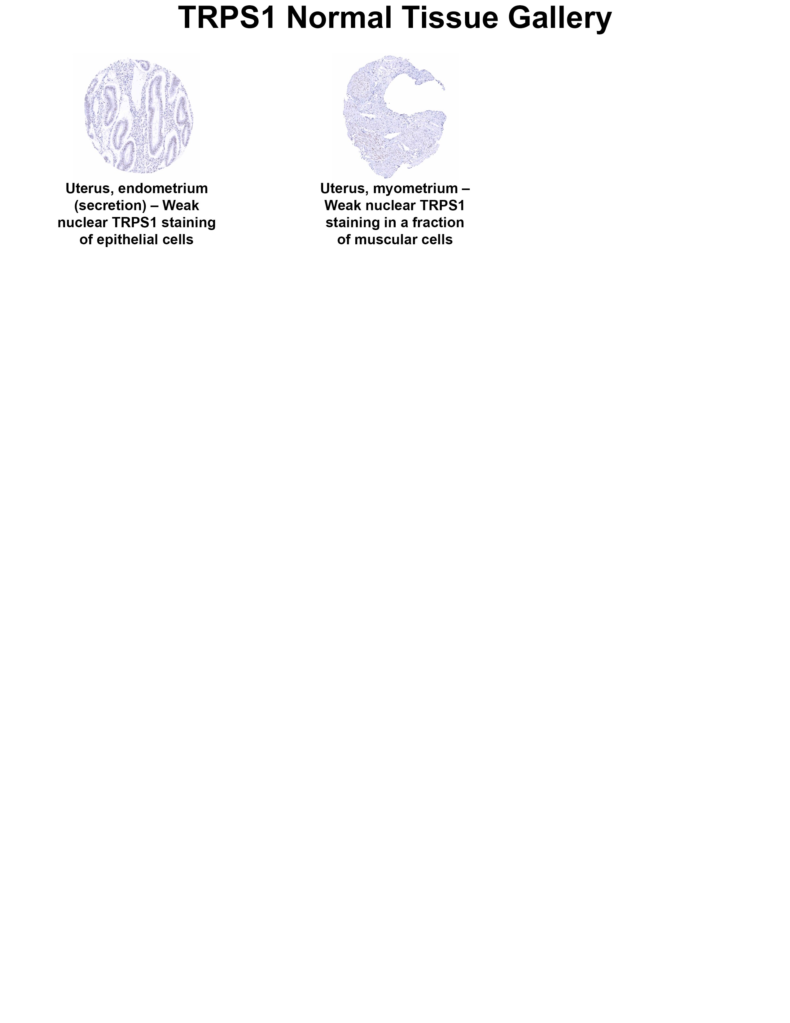 TRPS1 Antibody (MSVA-512R) TRPS1 Antibody (MSVA-512R) TRPS1 Normal Tissue Gallery