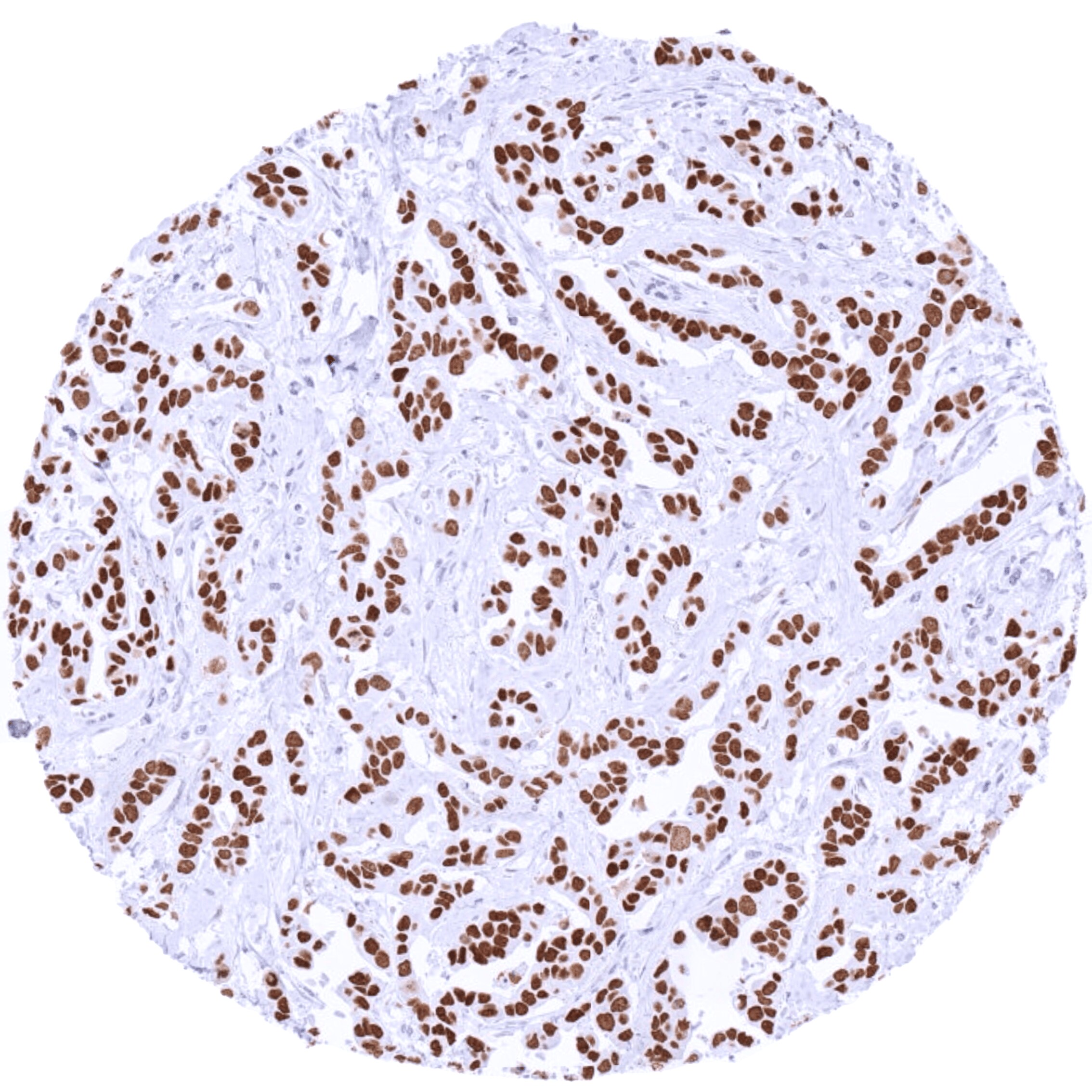 TRPS1 Antibody (MSVA-512R)