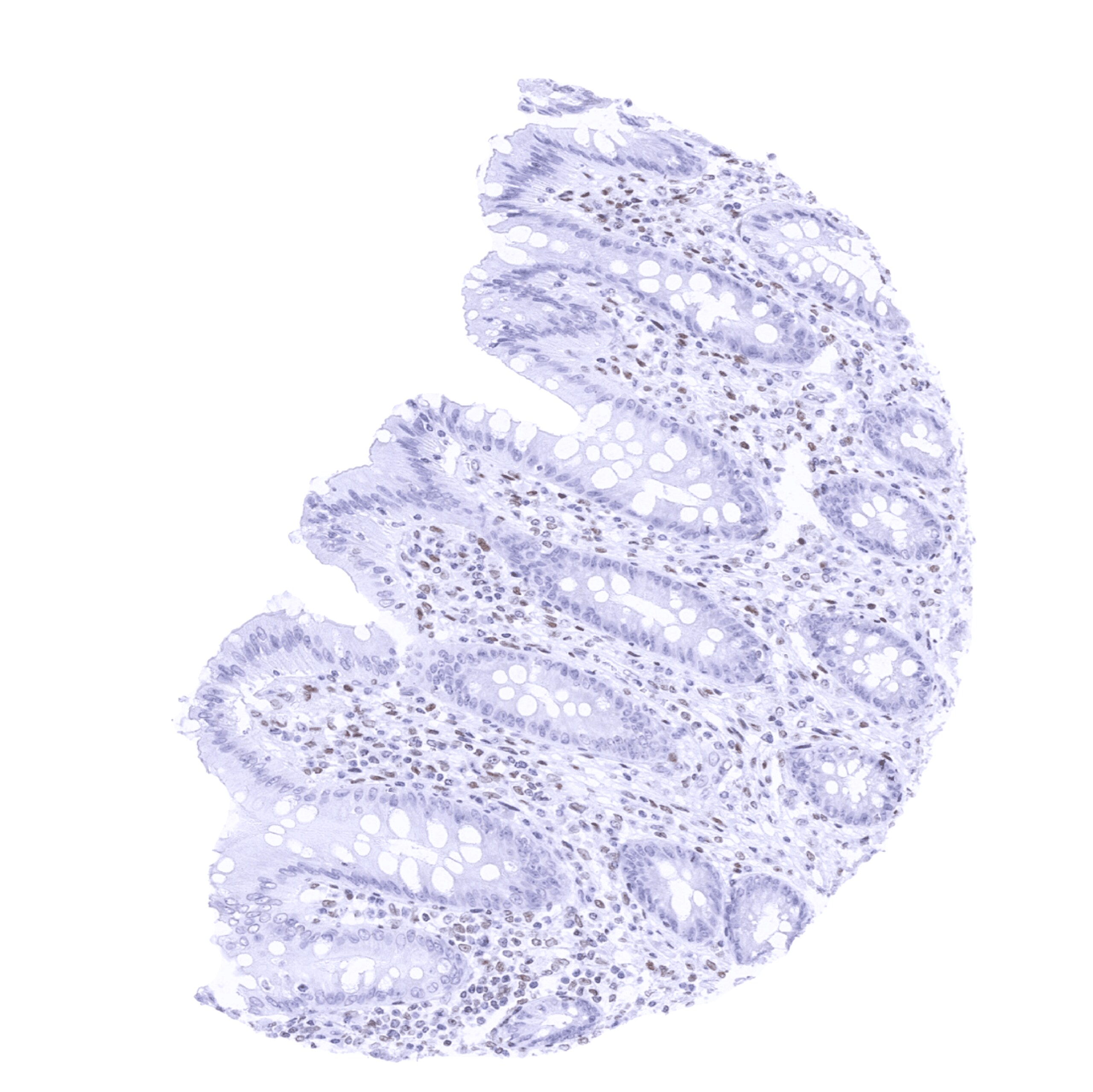 TRPS1 Antibody (MSVA-512R)