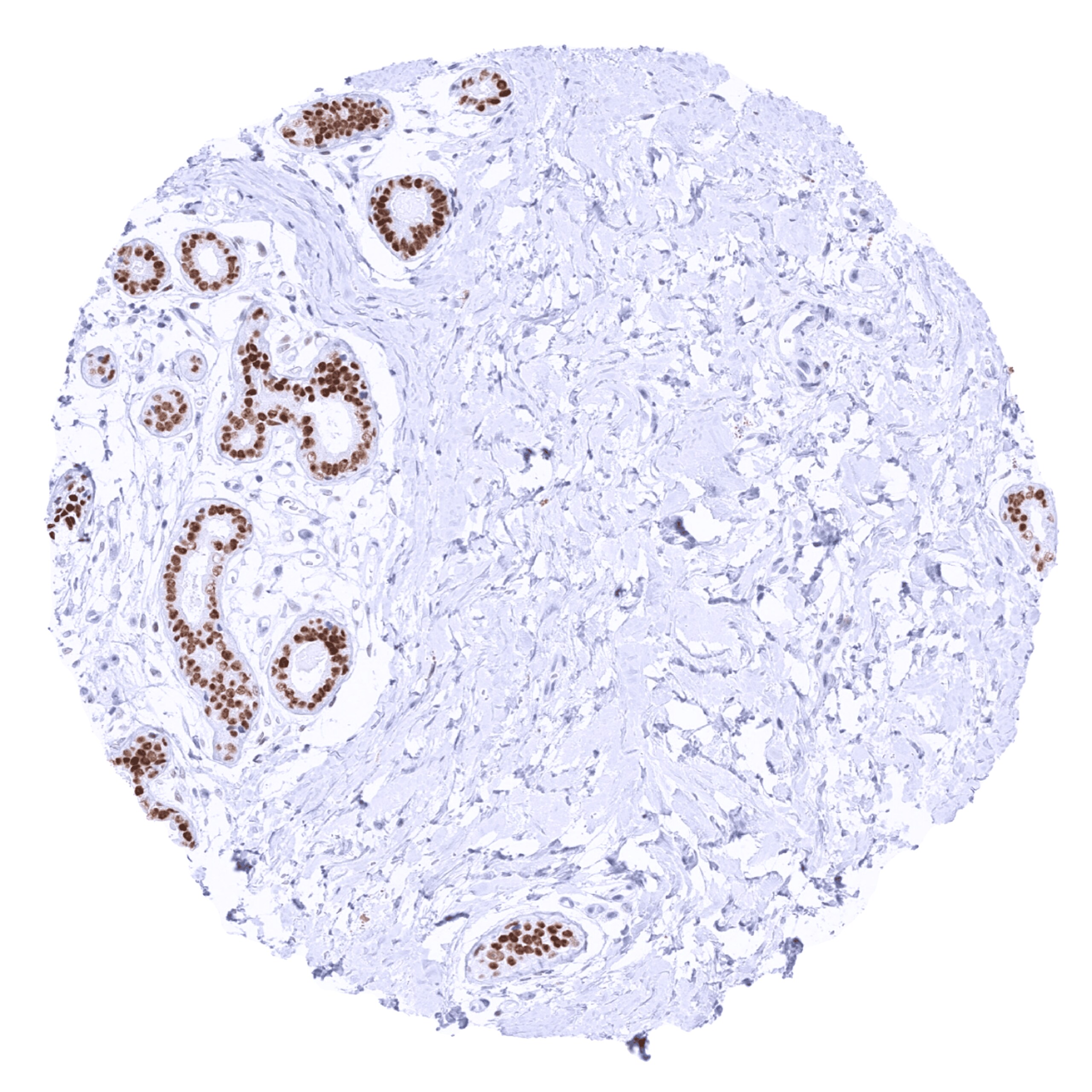 TRPS1 Antibody (MSVA-512R)